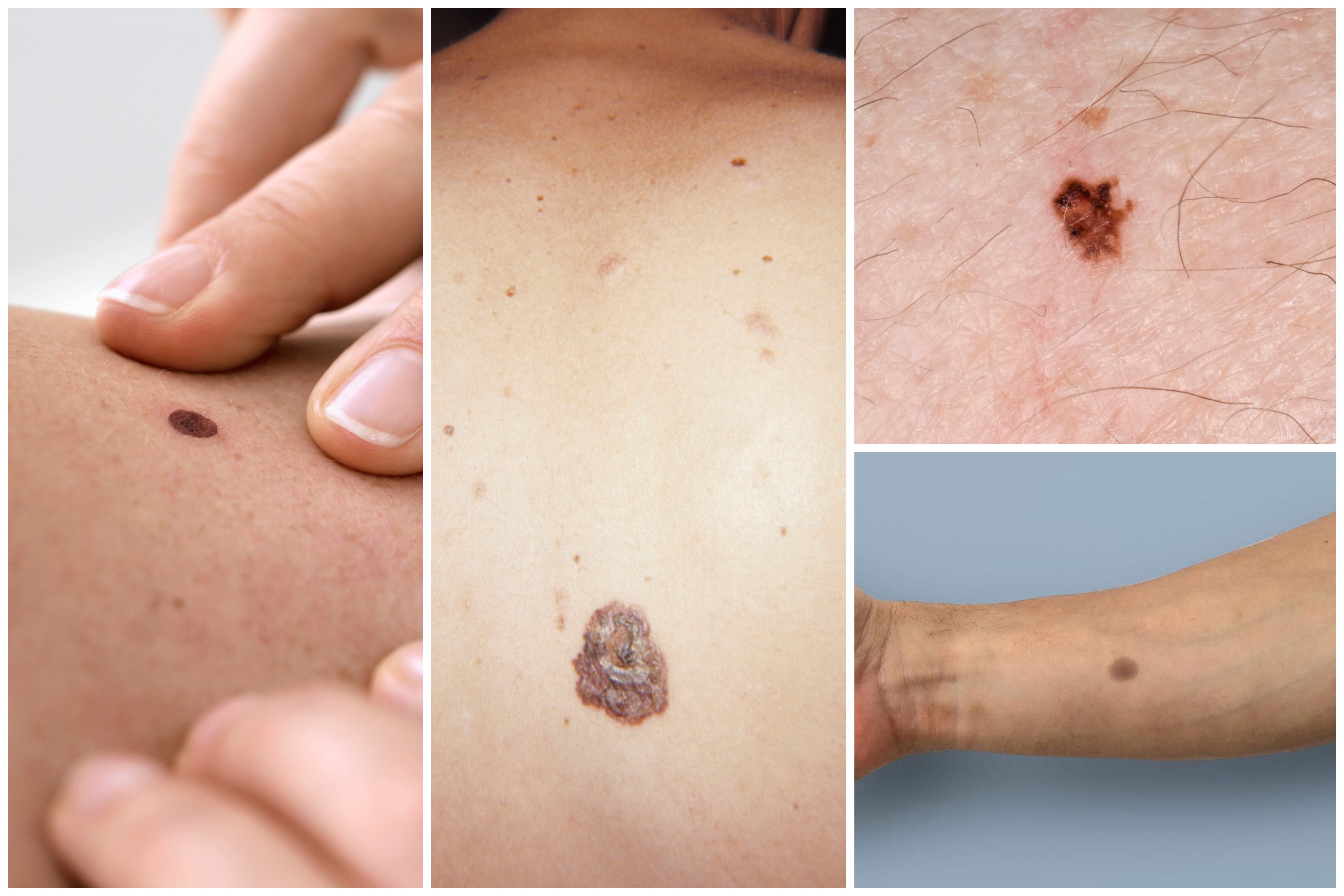 Mladeži kombo Foto: LEA PATERSON / Sciencephoto / ETH / Ferrari / DR P. MARAZZI / Sciencephoto / Custom Medical Stock Photo / Alamy / Profimedia