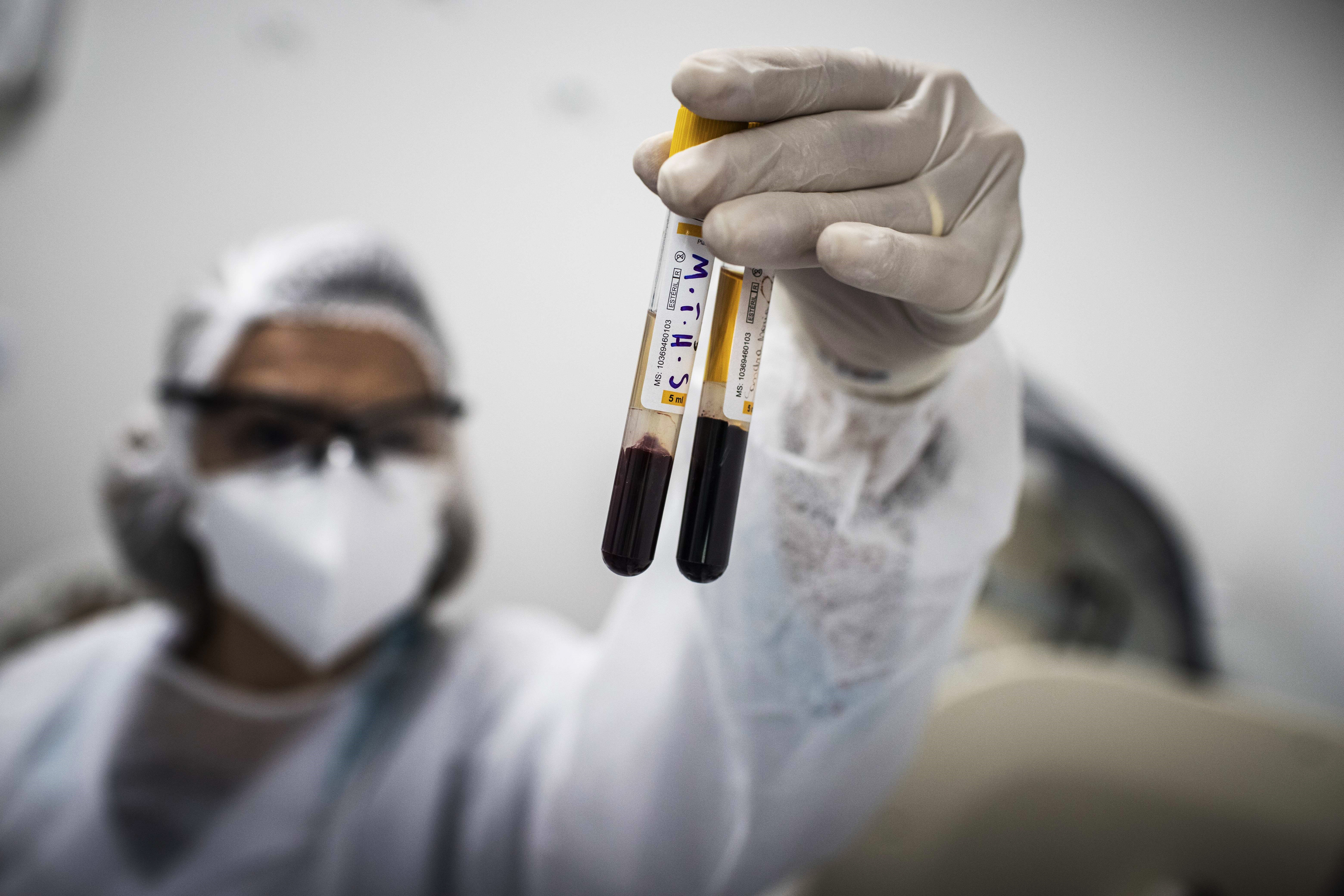 uzorci krvi; naučnik