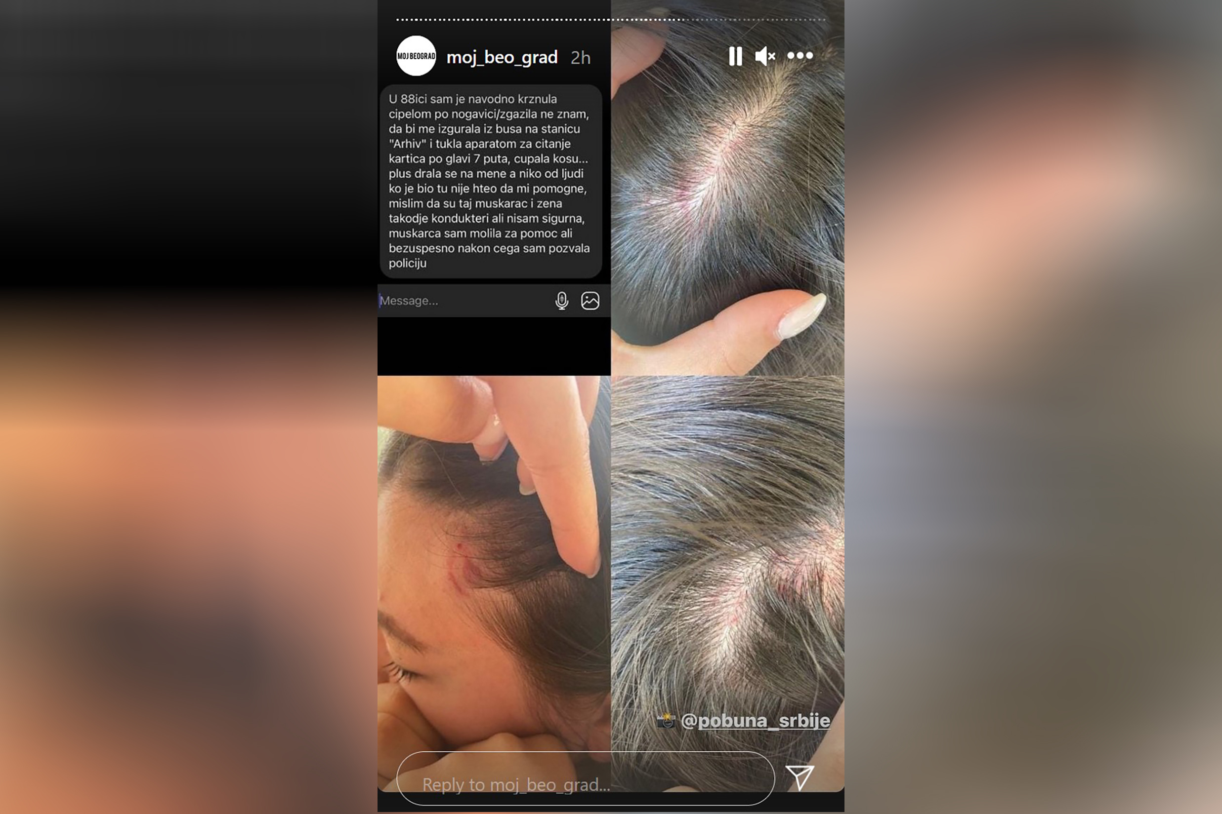 Povrede Foto: Printscreen/Instagram story/moj_beo_grad/@pobuna_srbije