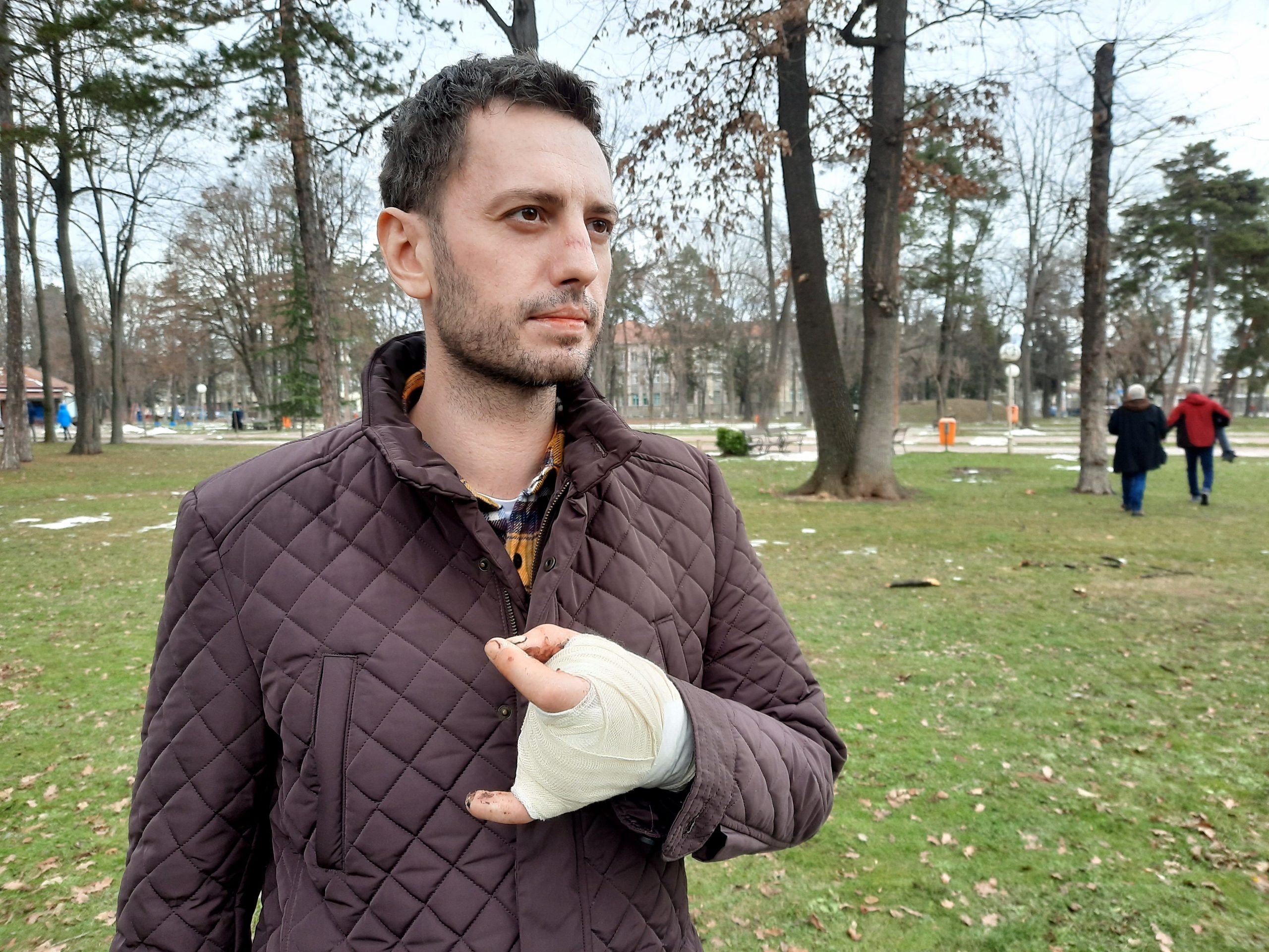 Nikola Ćirković, petarda, povreda Foto: Aleksandra Petrović/Nova.rs