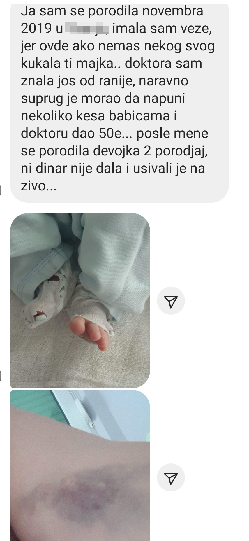 Porodilišta, porodilište, iskustva porodilja Foto: Instagram
