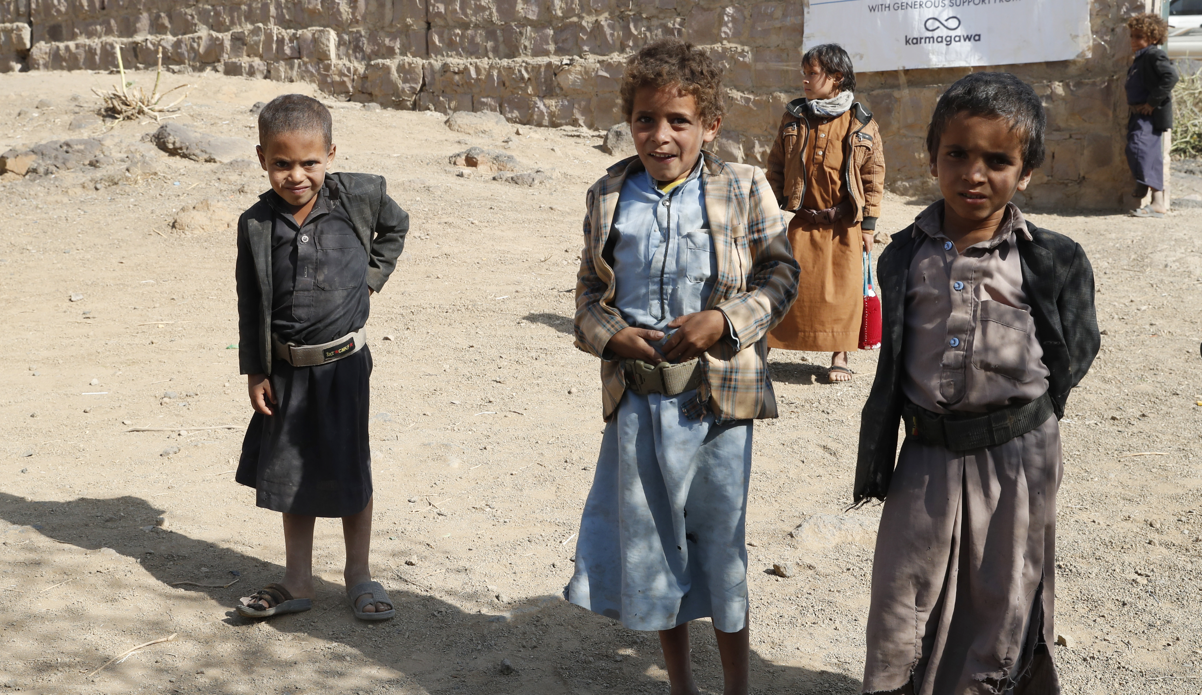 UN aid agencies warn of acute malnutrition among children in Yemen