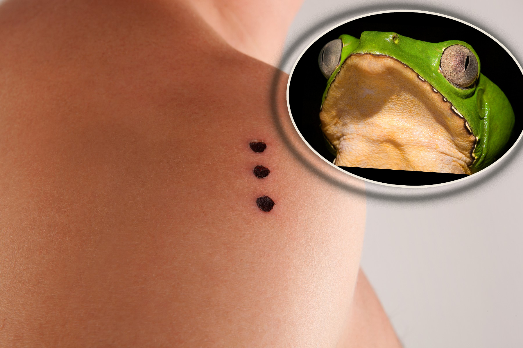 Kambo, frog medicine.