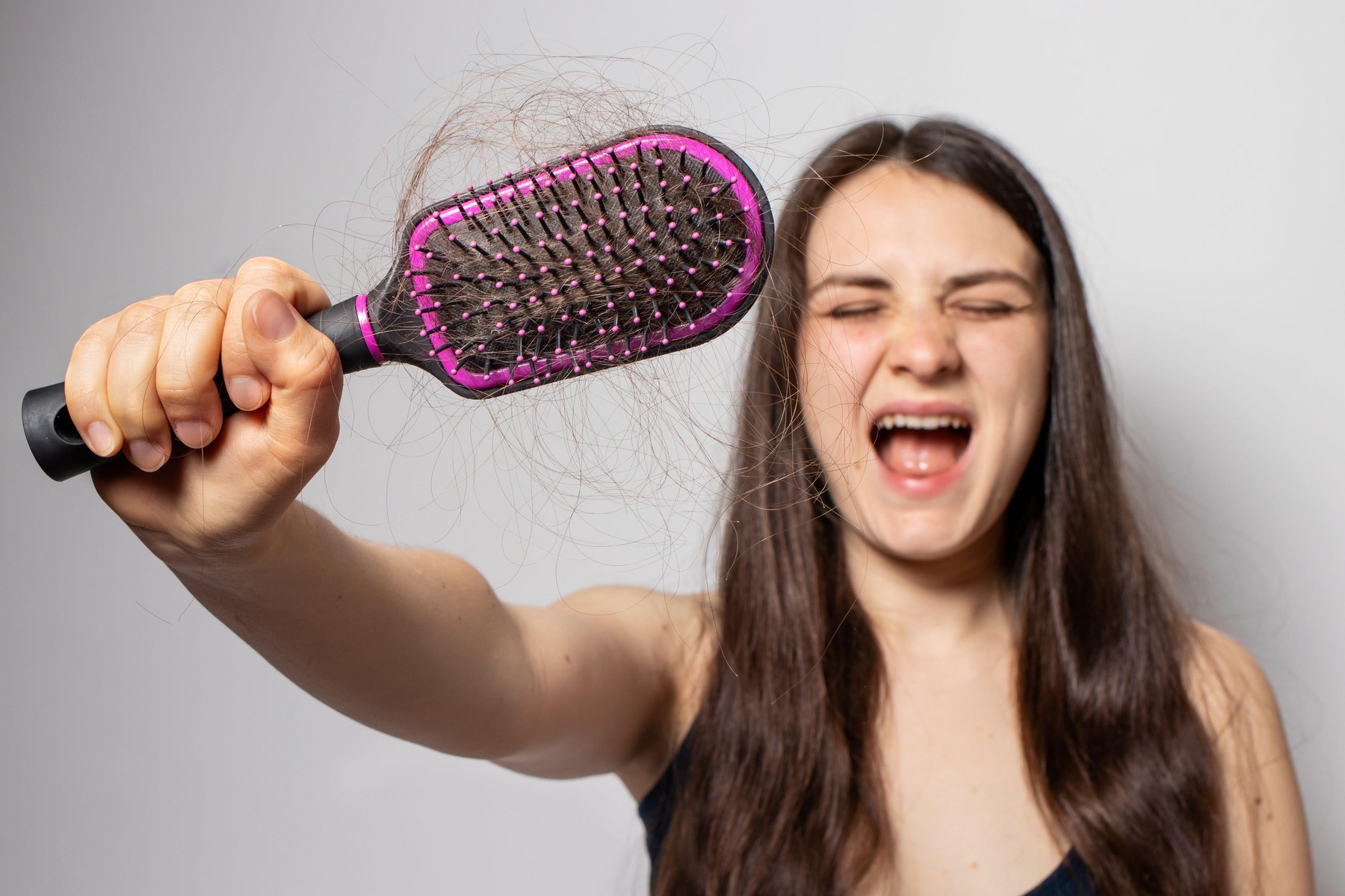 The girl holds a comb for hair with fallen hair. Hair loss, hair care.,Image: 548928231, License: Royalty-free, Restrictions: , Model Release: yes, Credit line: / Alamy / Alamy / Profimedia