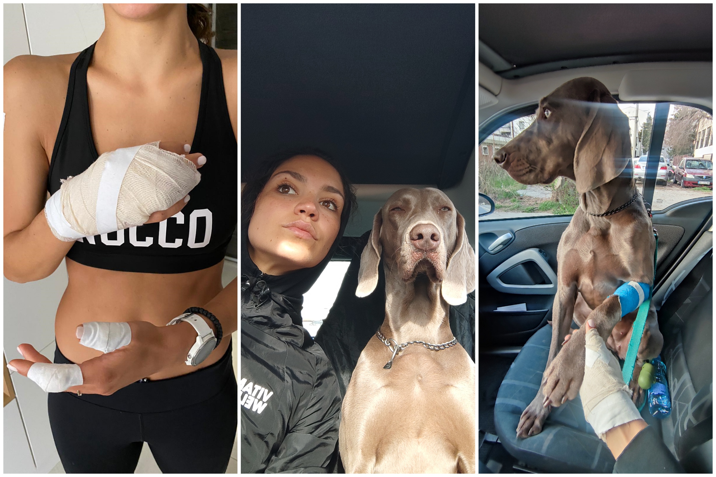 Nela Bunčić, Vasi, pas, povrede, napad psa Foto: Privatna arhiva