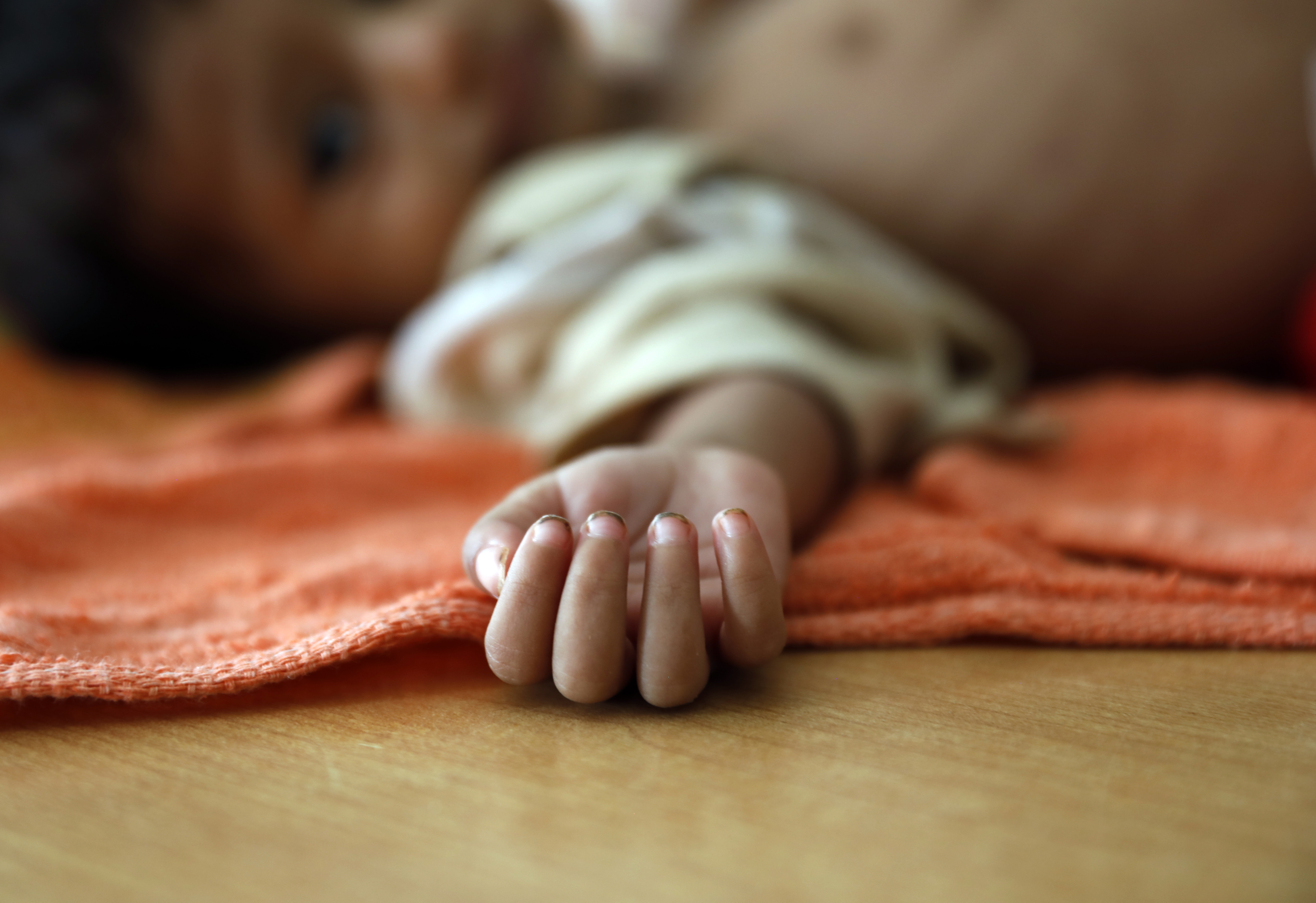 Child malnutrition worsens in Yemen due to lack of UN relief funding