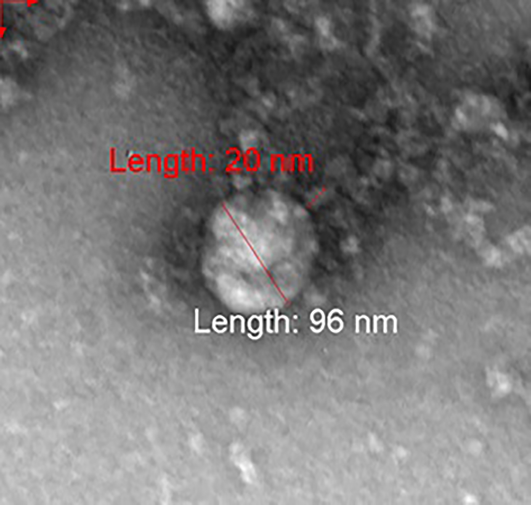 koronavirus  britanski soj Russia photographs 'British contagious mutation of Covid-19 for the first time'