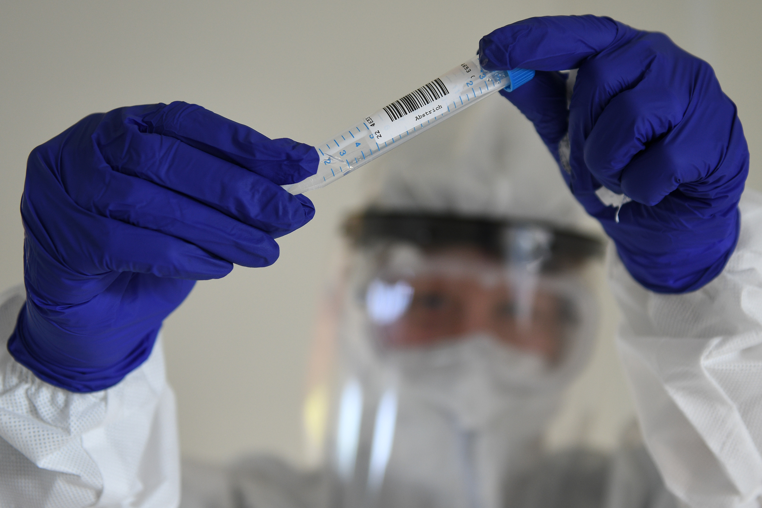 koronavirus test testiranje