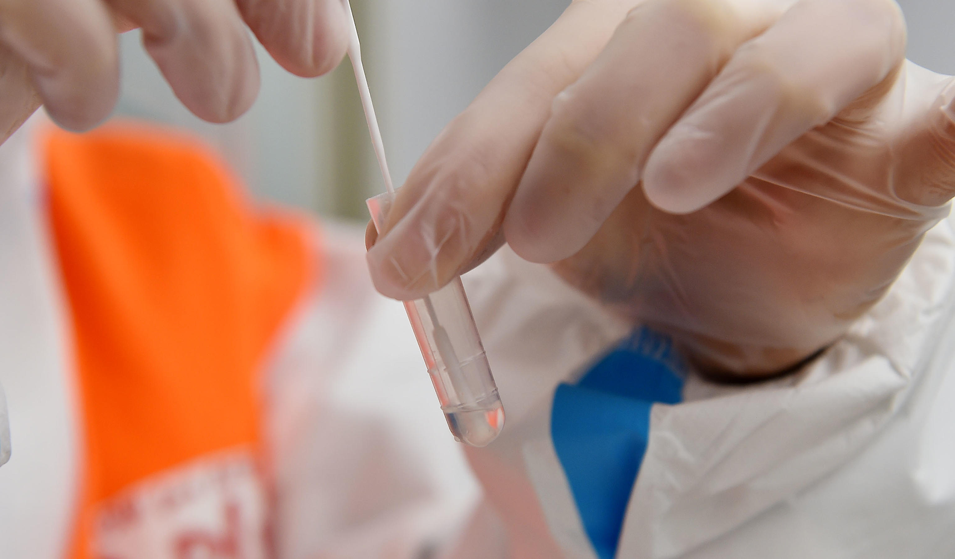 COVID-19, rapid swabs at Cottolengo hospital in Turin