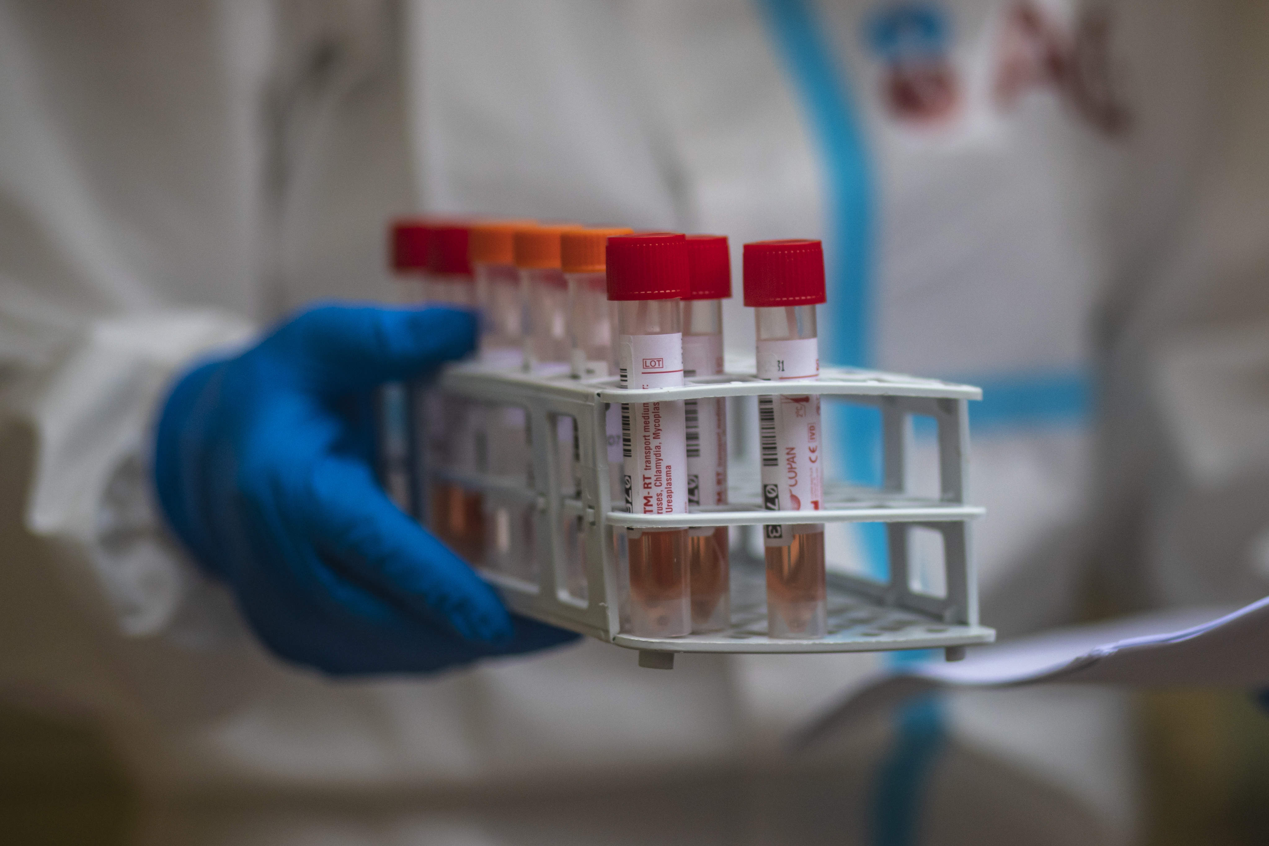 Daily life amid coronavirus in Prague koronavirus test testiranje