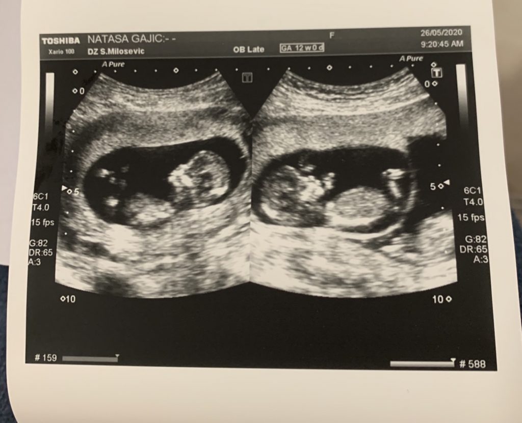 Natasa Gajic, korona porodilja