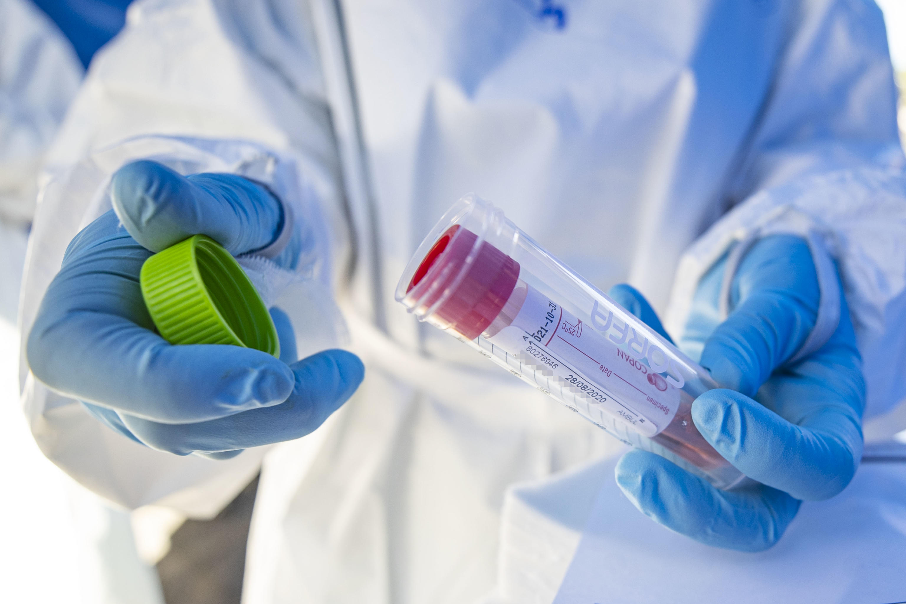 epa08631427 Health workers wearing overalls and protective masks perform swab tests at Via San Daniele del Friuli of the ASL Roma 1 health facilities in Rome, Italy, 28 August 2020.  EPA-EFE/MASSIMO PERCOSSI
