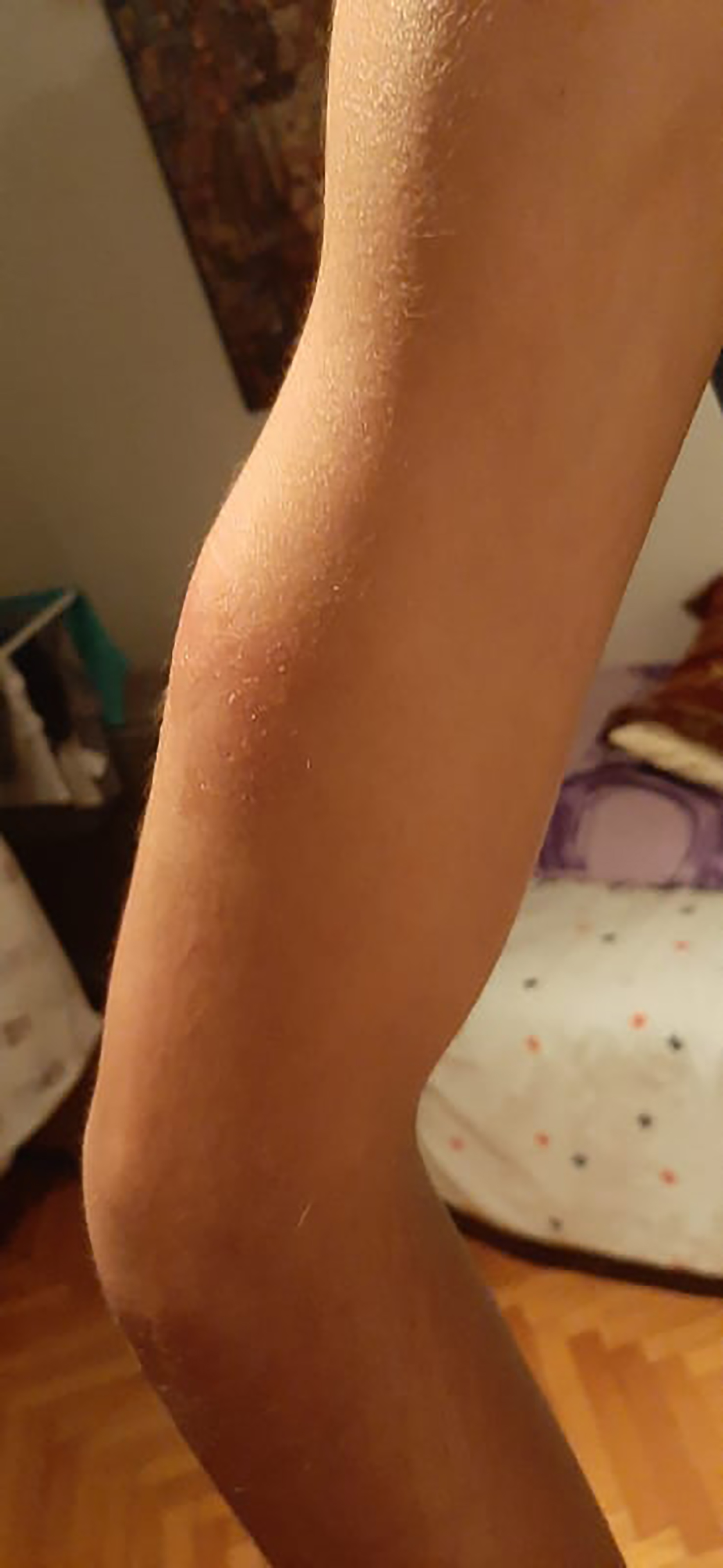 pretuceni decko foto Privatna arhiva (5)