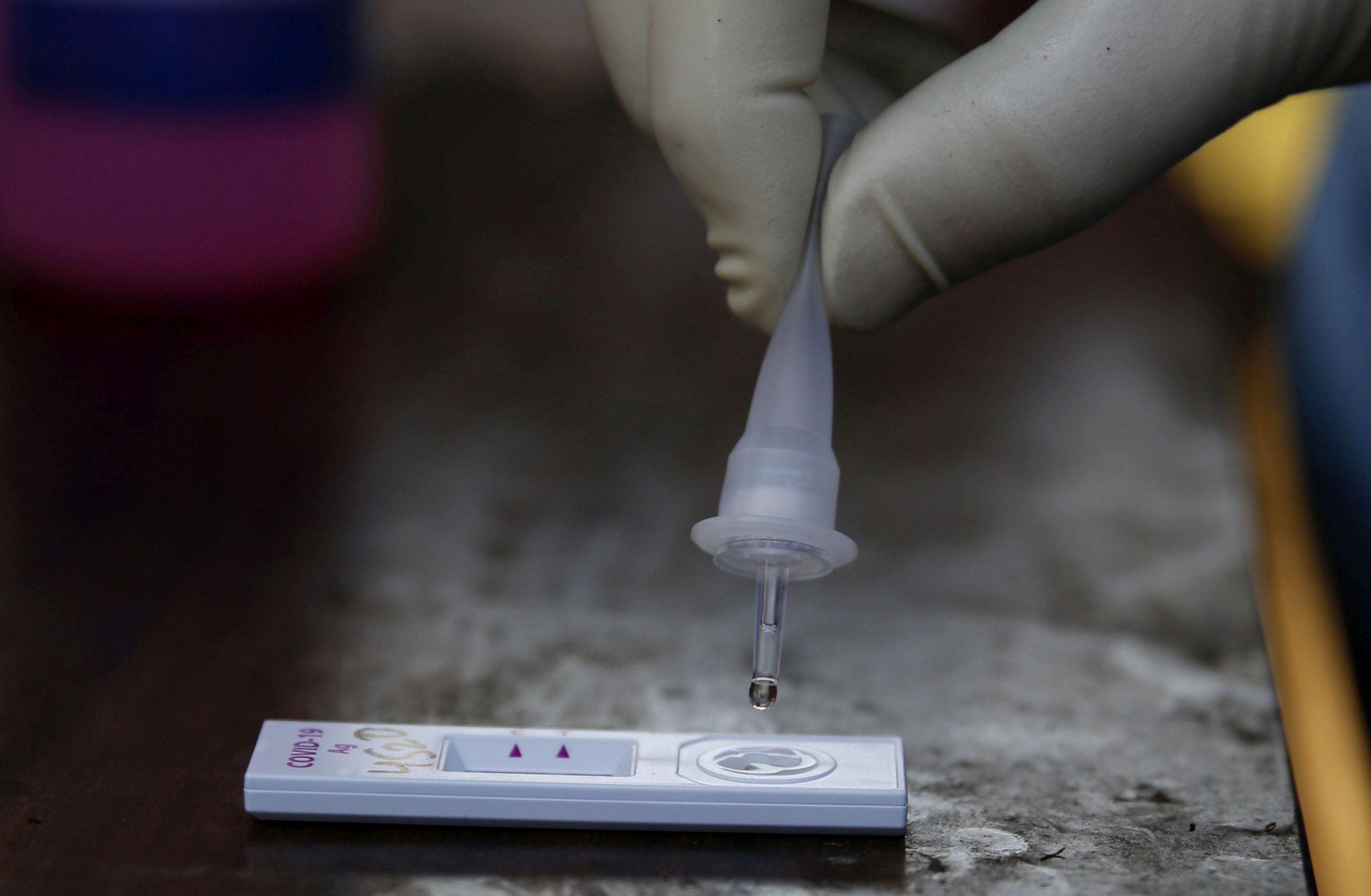 epa08743495 A paramedic puts a Covid-19 sample into a rapid antigen test kit in Srinagar, Indian Kashmir, 14 October 2020. India is currently the second worst hit country by the coronavirus in the world after the United States.  EPA-EFE/FAROOQ KHAN