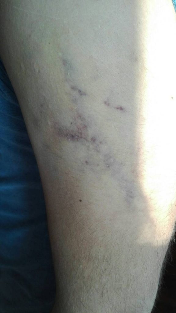 Mario Markovic povredjen