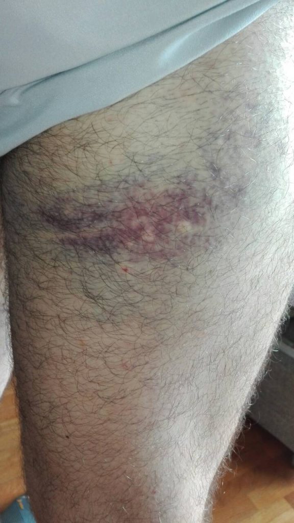 Mario Markovic povredjen