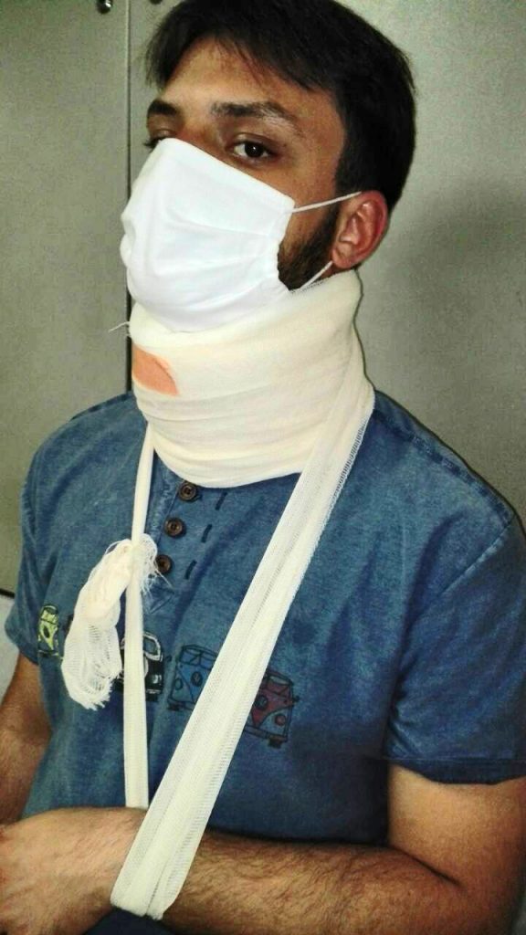 Marijo Markovic povredjen