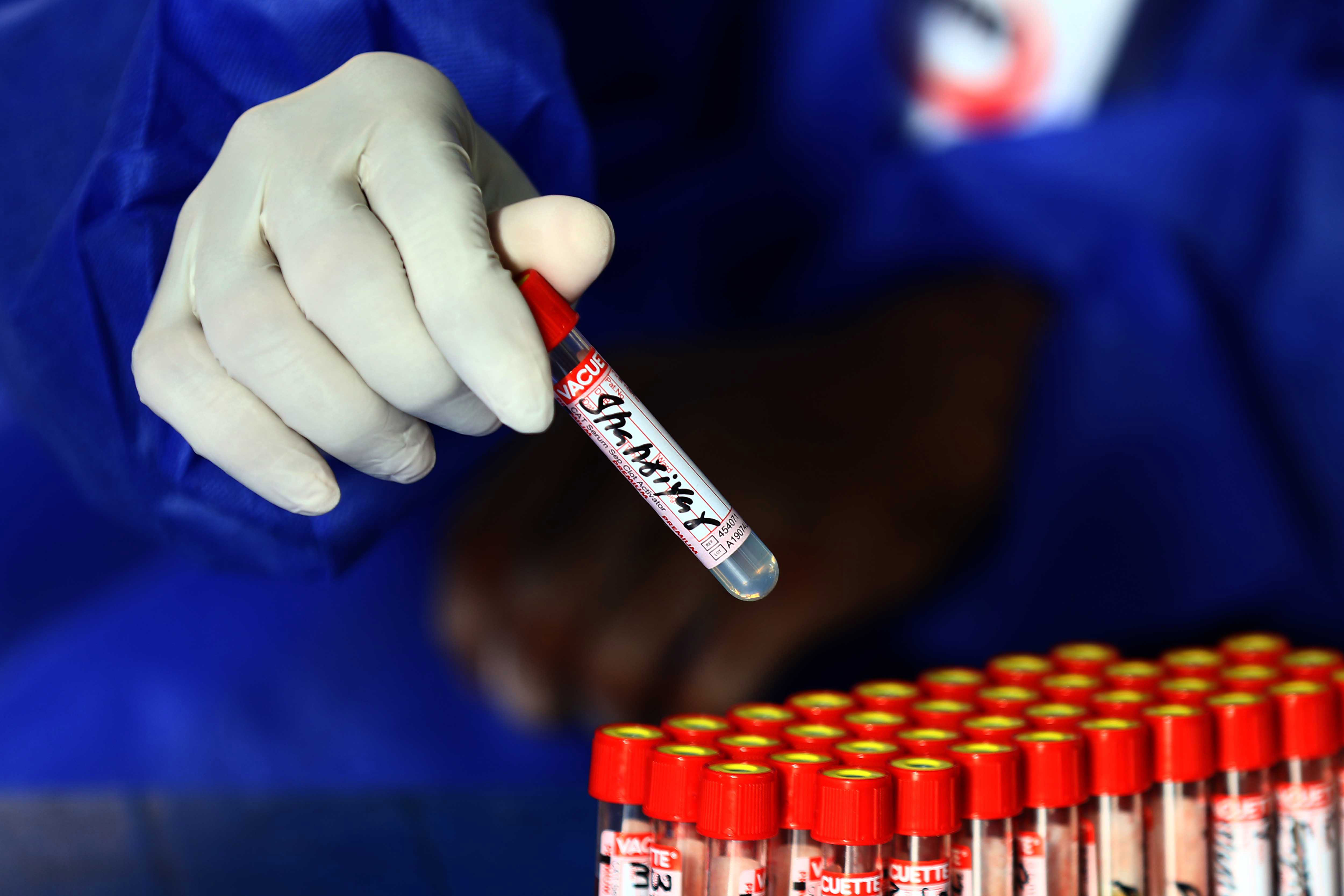 koronavirus test testiranje