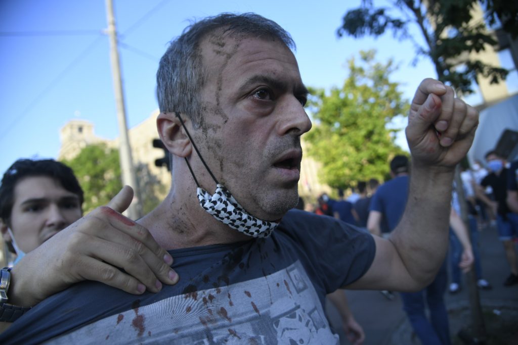 Beograd 08.07.2020. Protest, drugi dan demonstracija, Sergej Trifunović Foto: Nemanja Jovanovic/Nova.rs