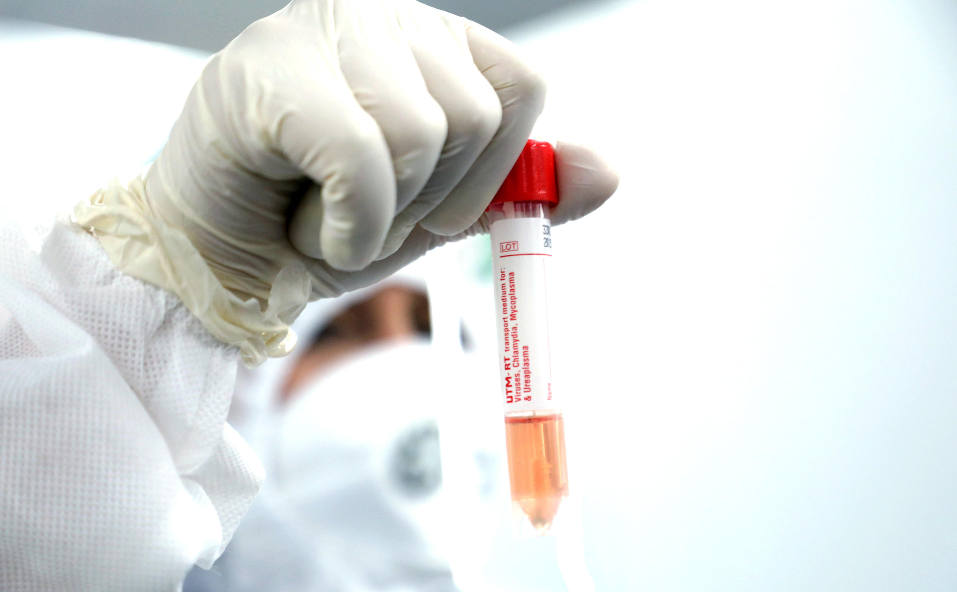 epa08615910 Health workers collect swab samples from passengers at Linate airport in Milan, Italy, 21 August 2020.  EPA-EFE/MATTEO BAZZI