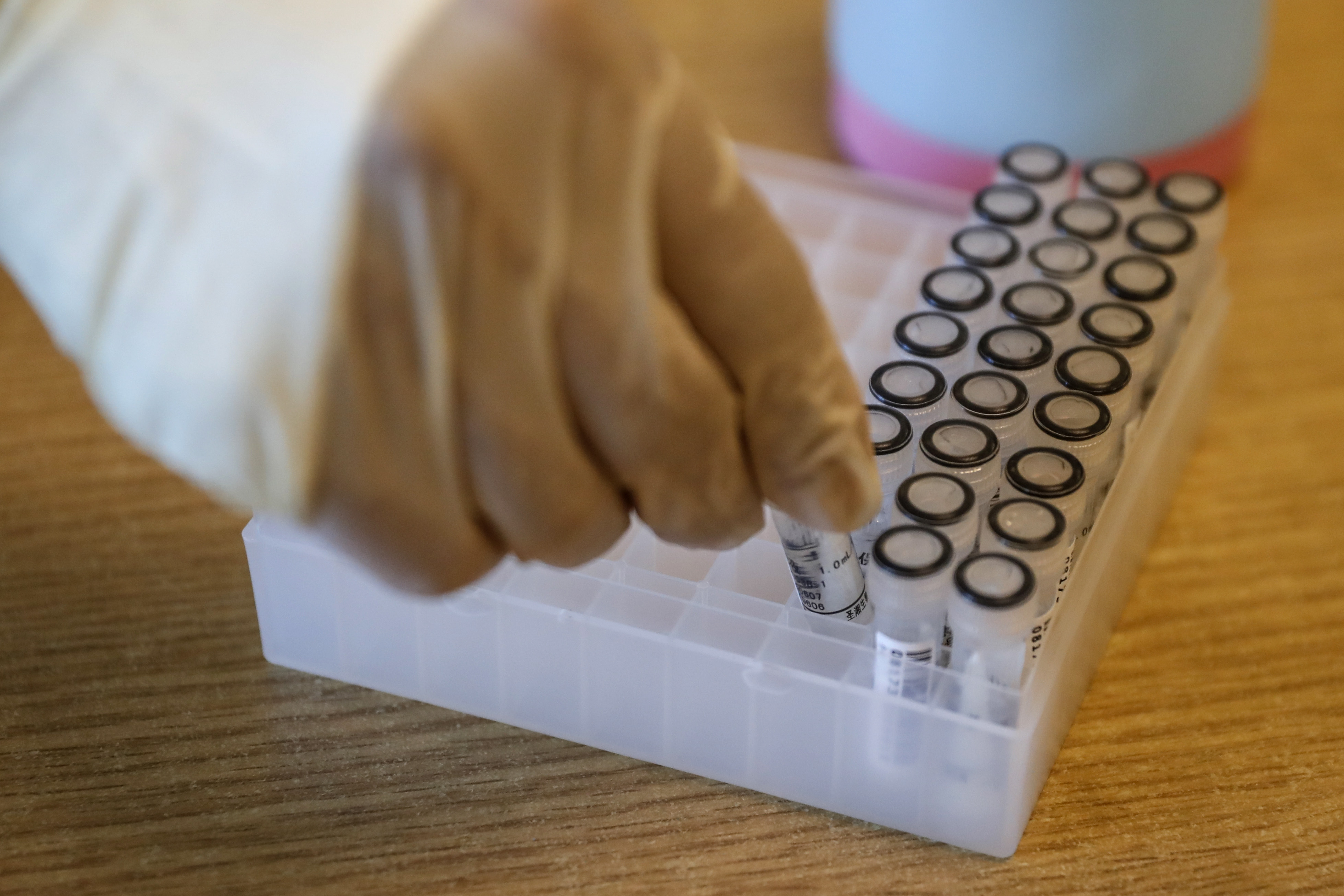 COVID-19 testing in China koronavirus testiranje