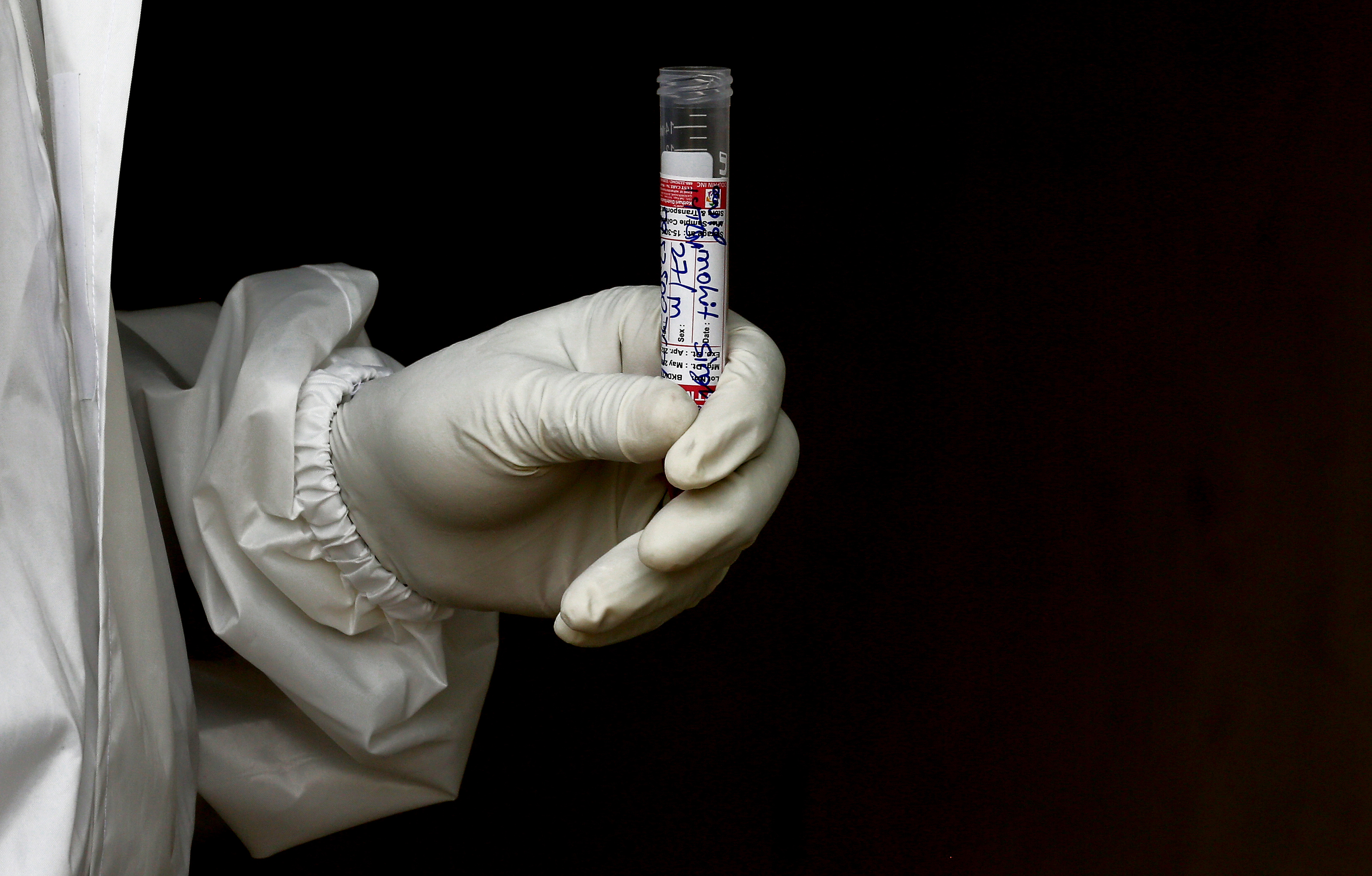 koronavirus test testiranje