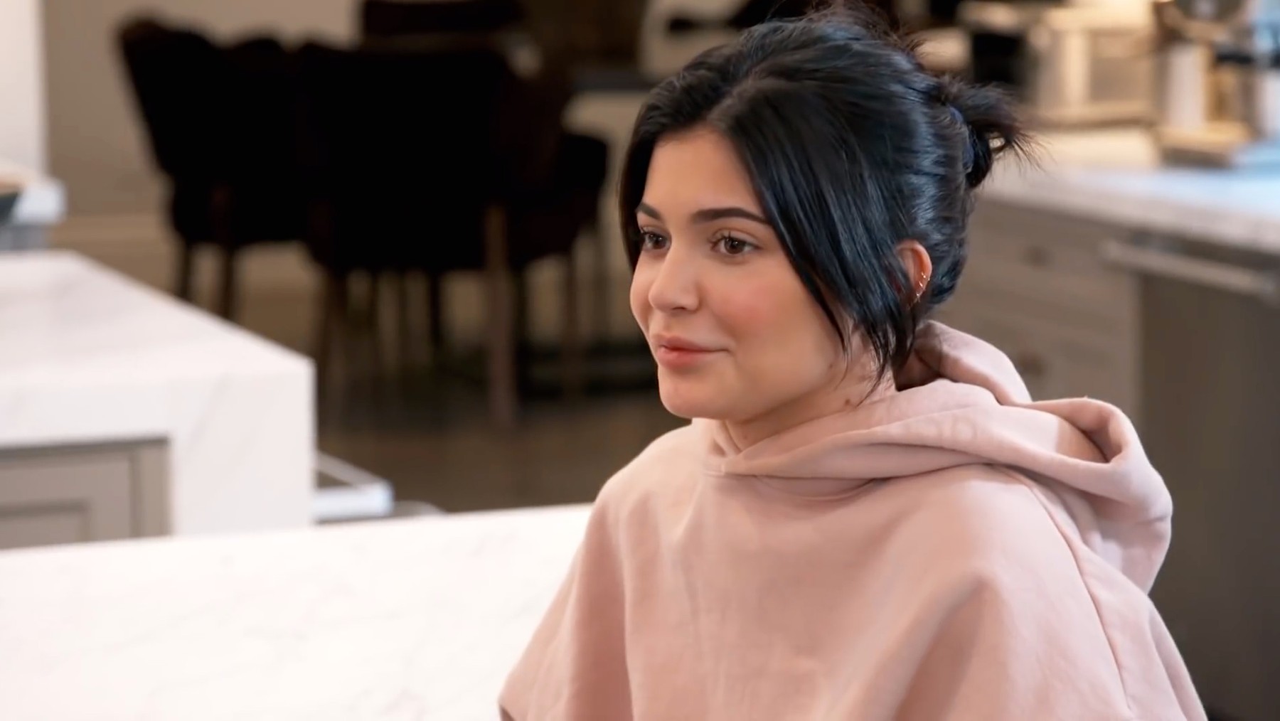 Kylie Jenner laser surgery decision  is an eye opener
