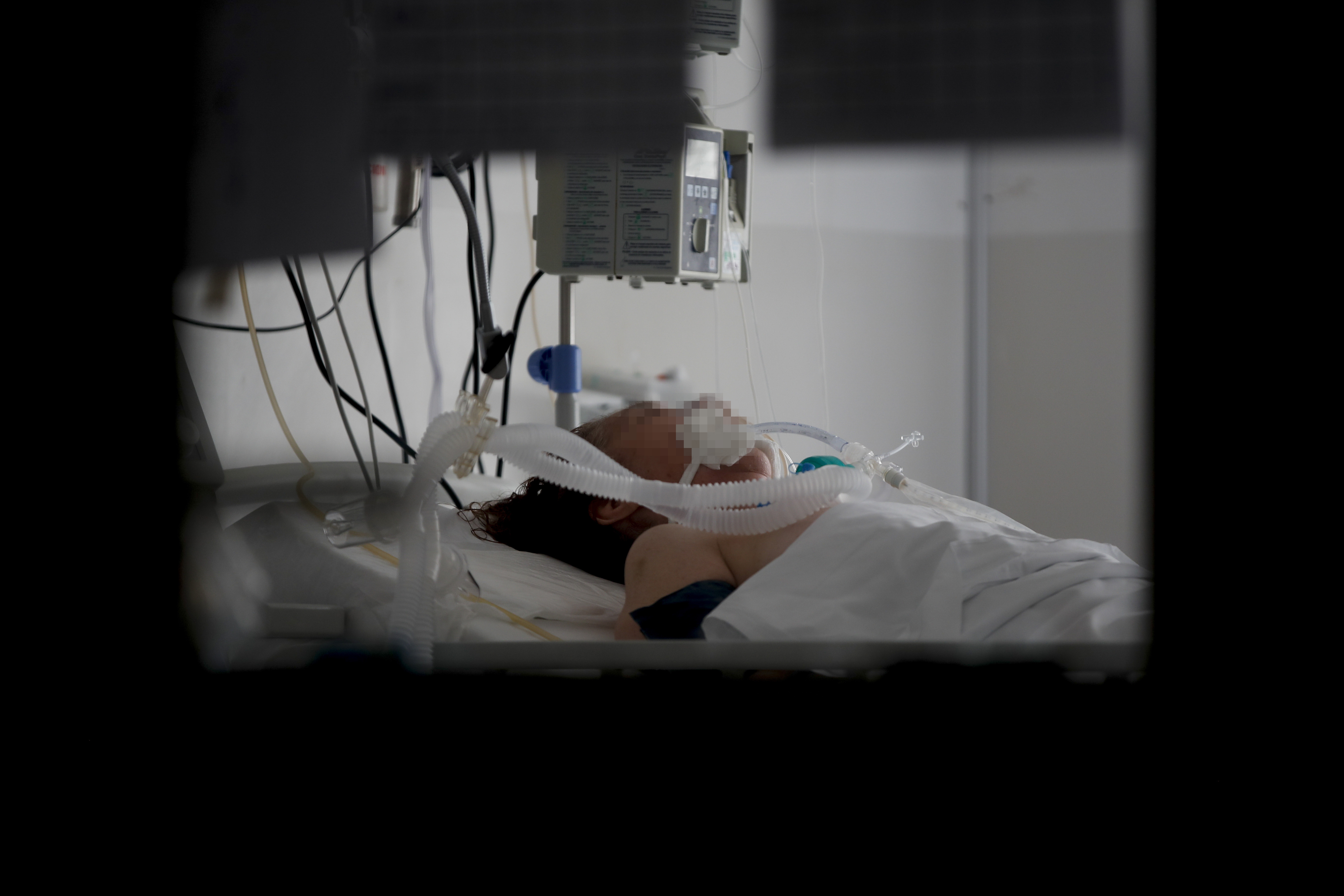A COVID-19 patient rests at the Eurnekian Ezeiza Hospital on the outskirts of Buenos Aires, Argentina, Tuesday, July 14, 2020, during a government-ordered lockdown to curb the spread of the new coronavirus. (AP Photo/Natacha Pisarenko)