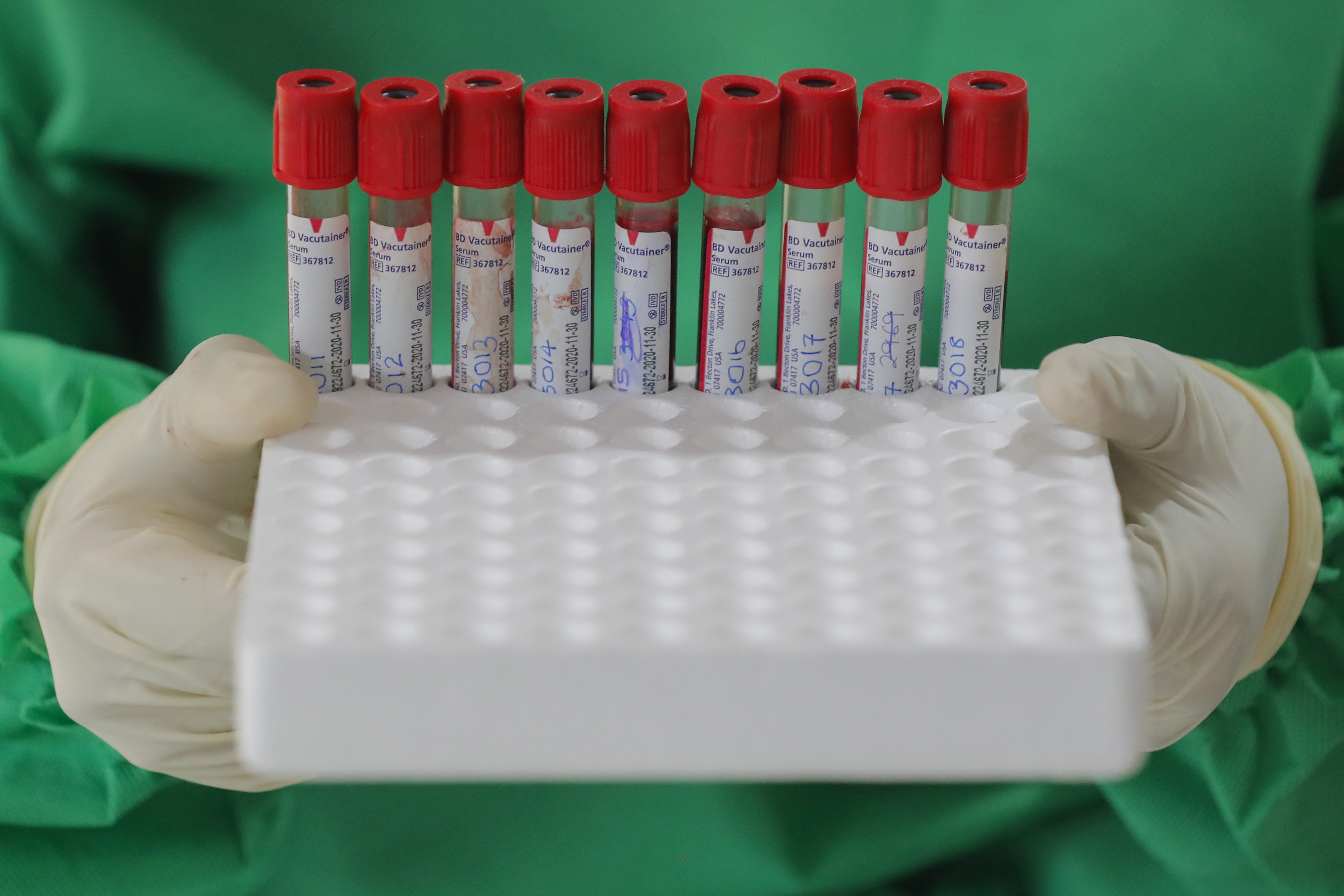 COVID-19 testing amid coronavirus pandemic in Sri Lanka