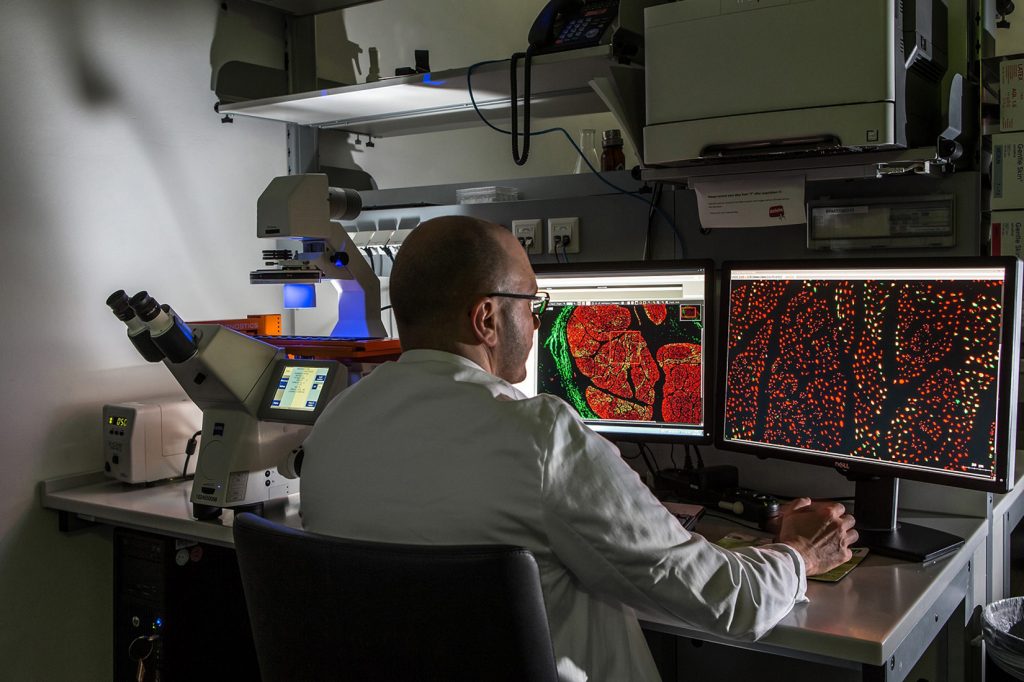 Obdukcije pokazale da COVID-19 izaziva plućnu emboliju i oštećuje organe Foto: ©MedUni Wien/Christian Houdek