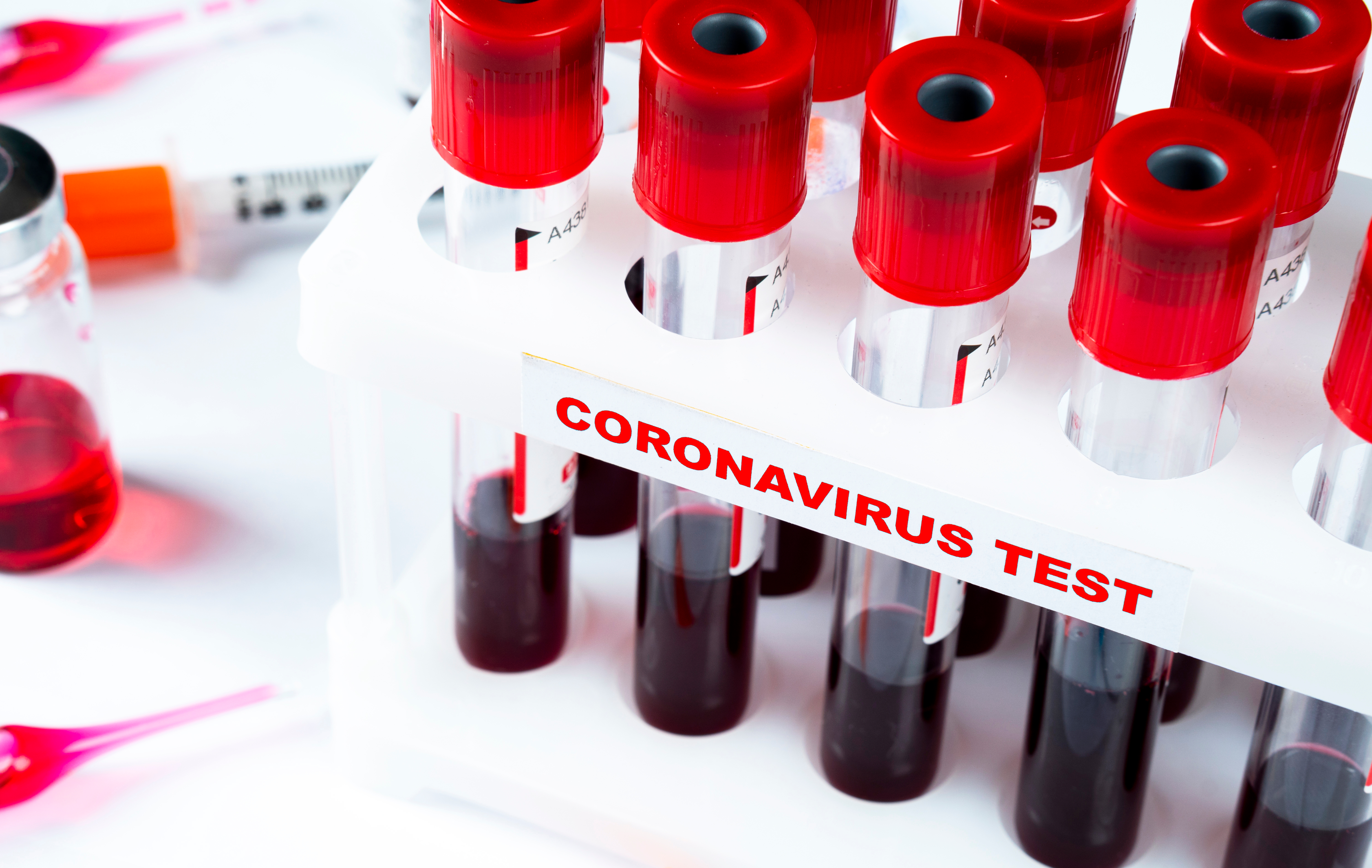 Ilustracija koronavirus test covid 19