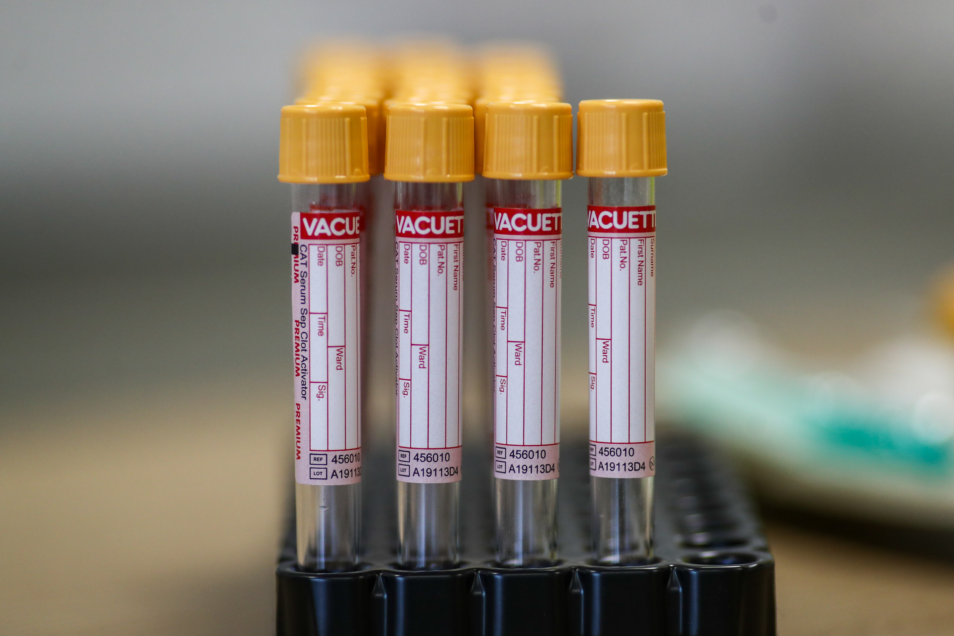 koronavirus testiranje test