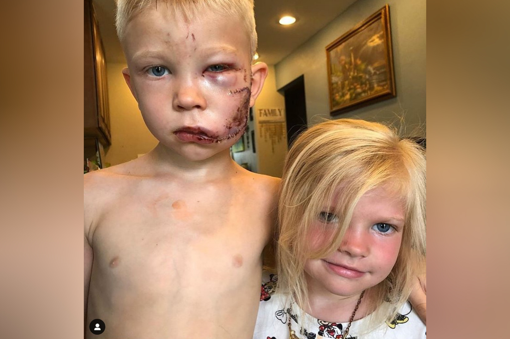 decak foto Instagramallthingsgoodc