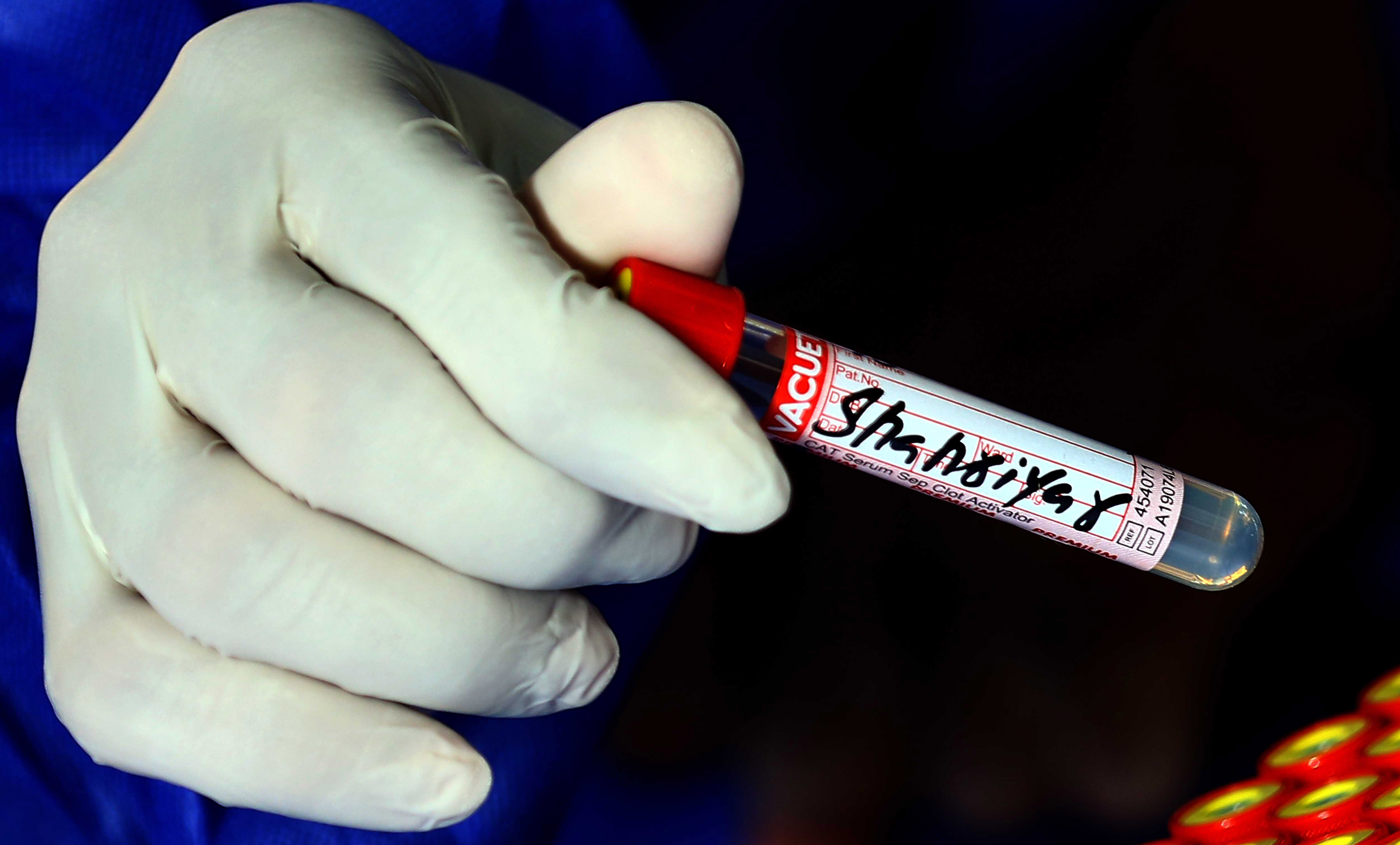 koronavirus test testiranje