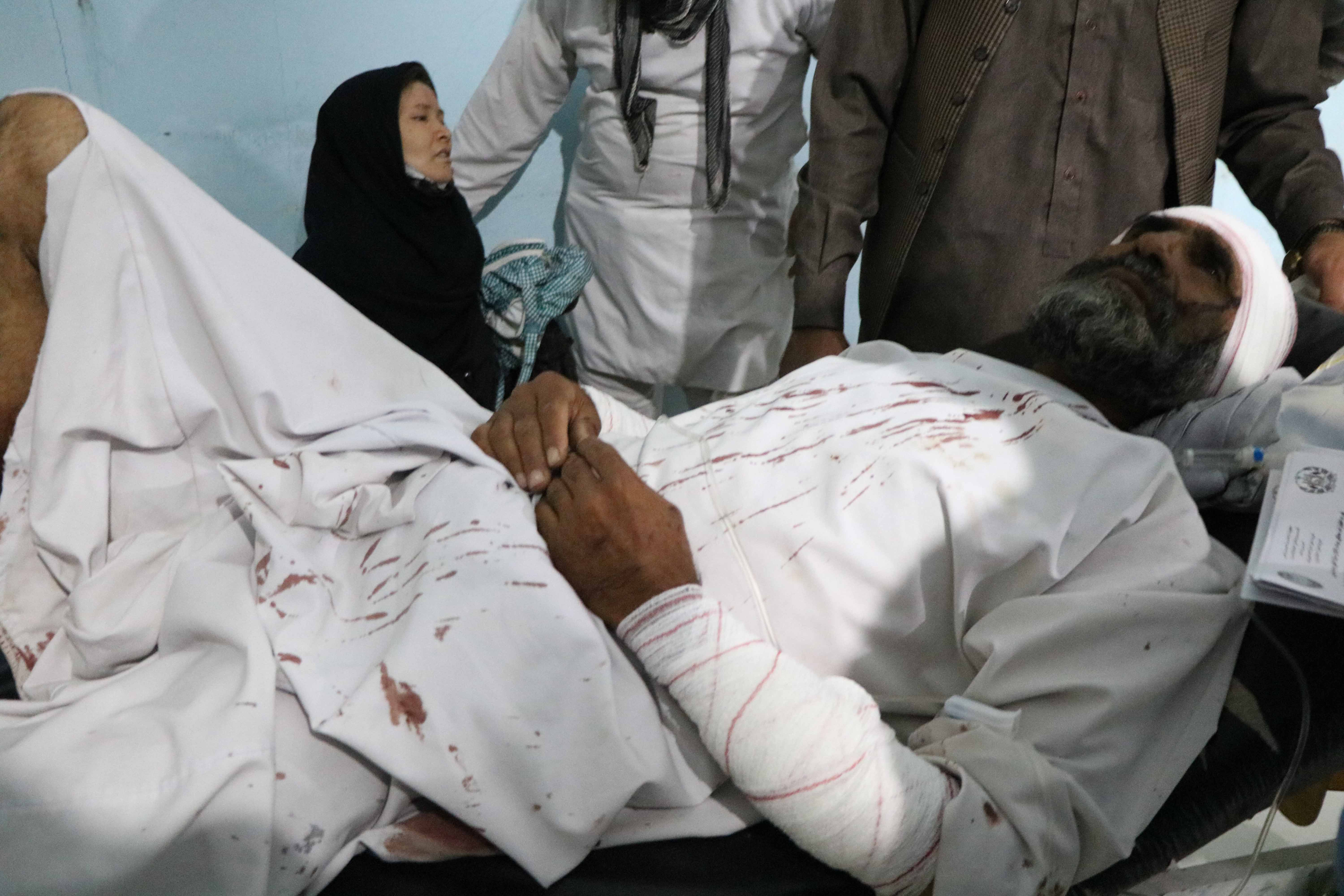 epa08573616 An Afghan man who was injured in a bomb blast receives medical treatment at a hospital in Herat, Afghanistan, 29 July 2020. At least 3 civilians were killed when their vehicle hit a bomb in Herat.  EPA-EFE/JALIL REZAYEE