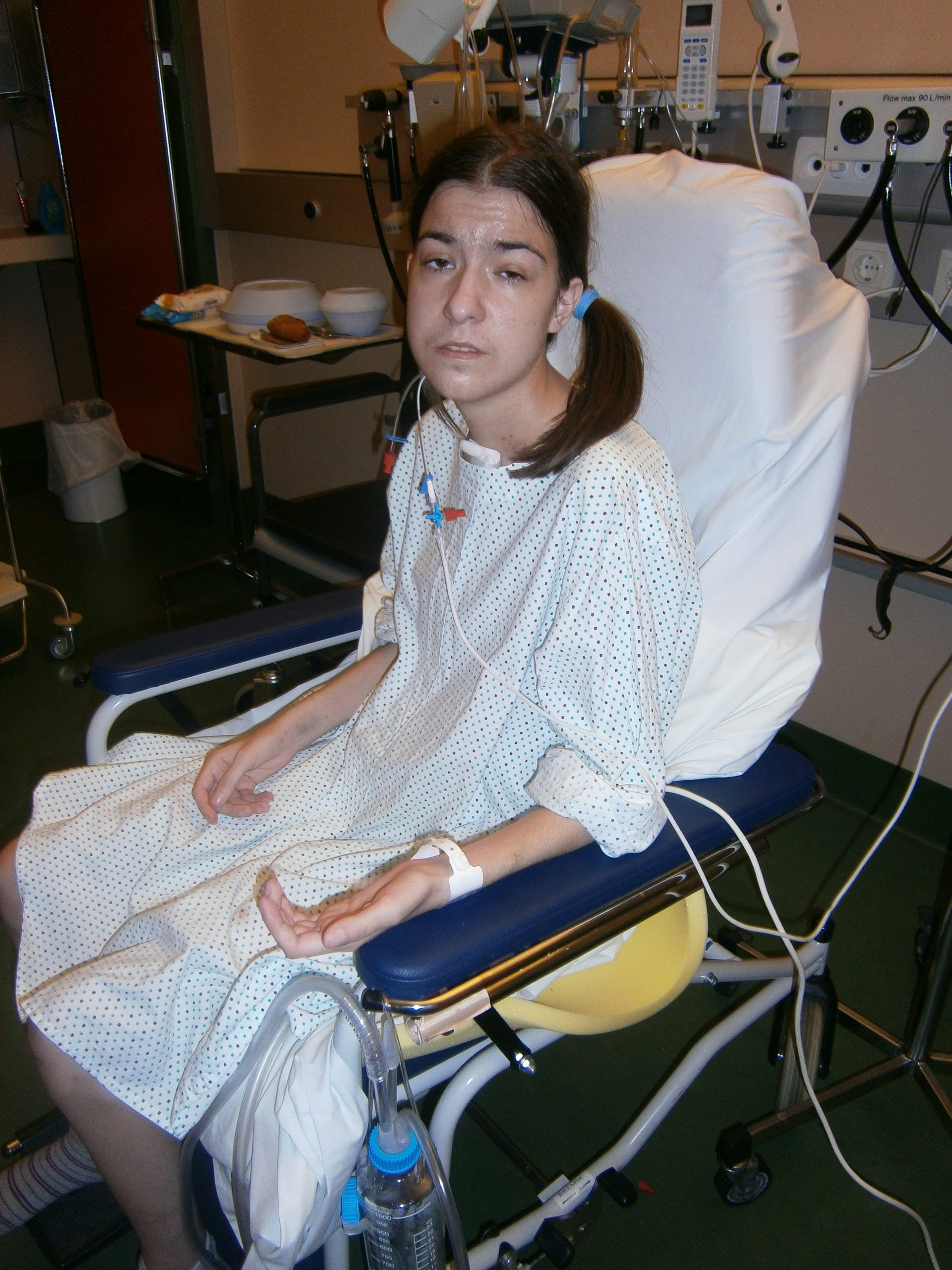 Sandra Živković, transplantacija pluća