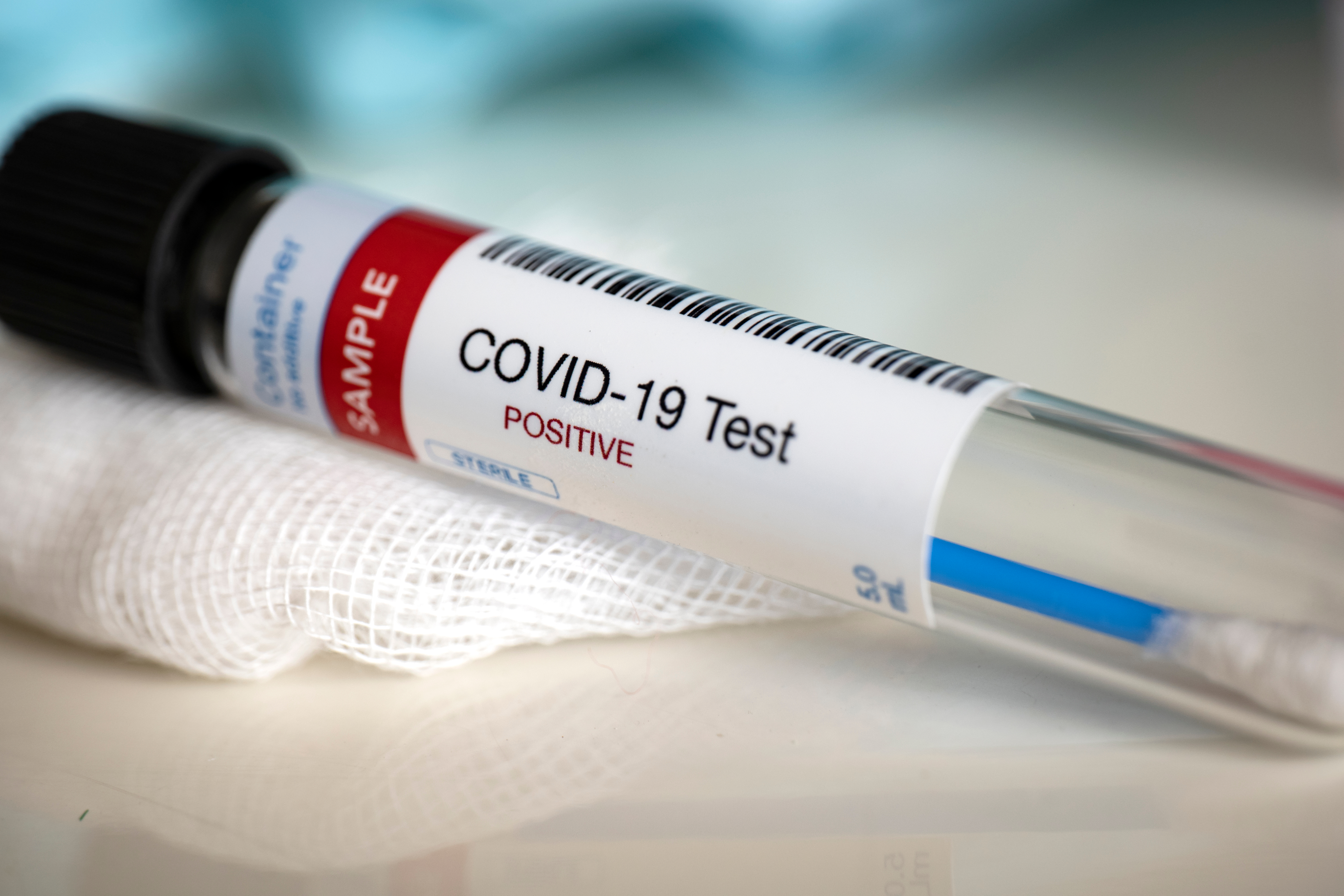Koronavirus, ilustracija Foto: Shutterstock