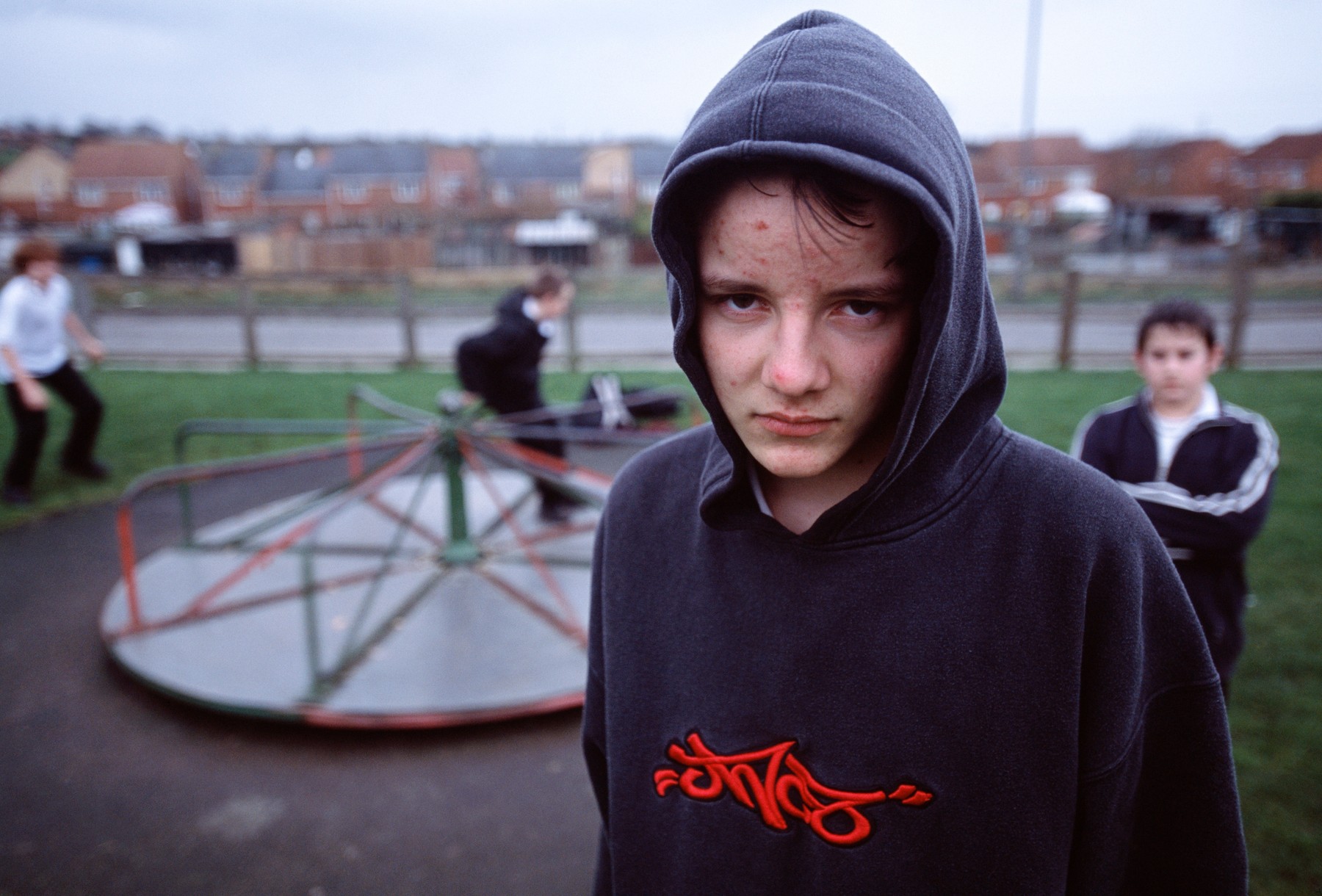 Boy with acne