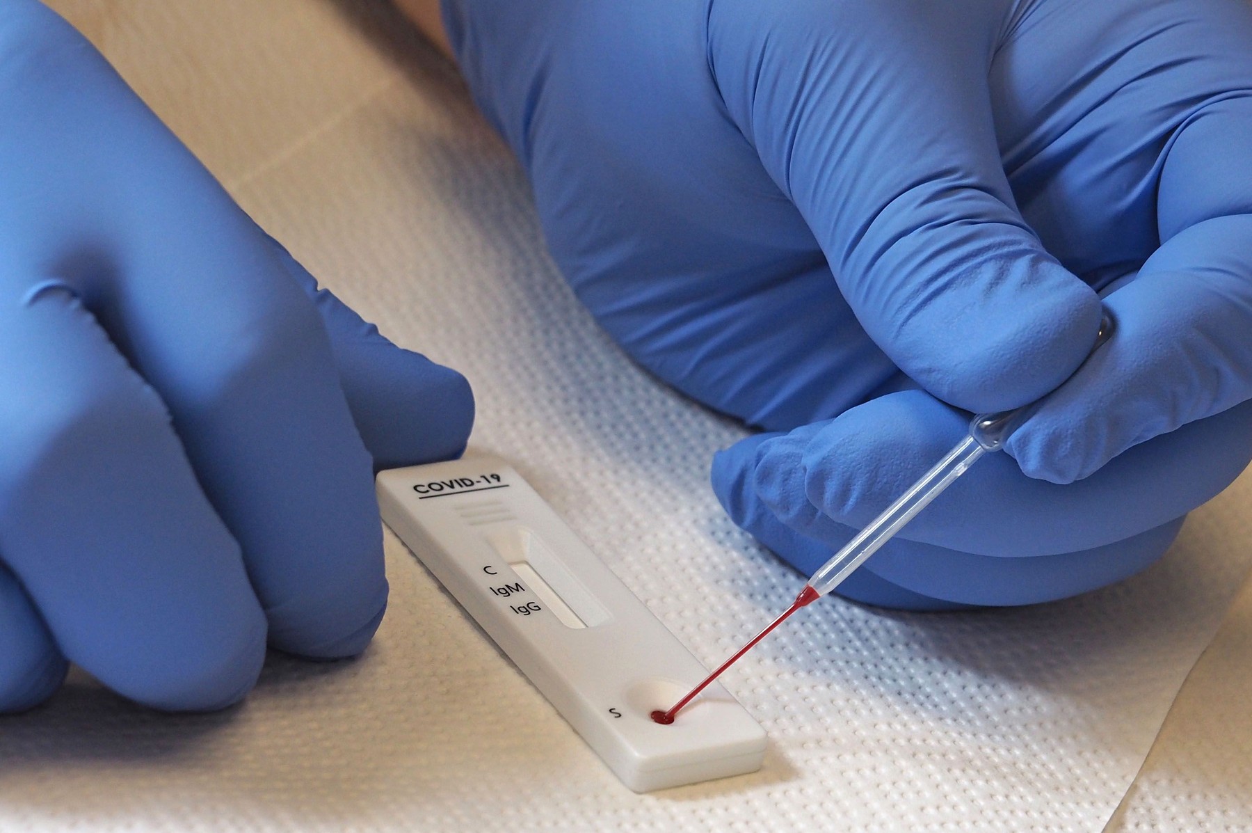Italy, coronavirus serological tests