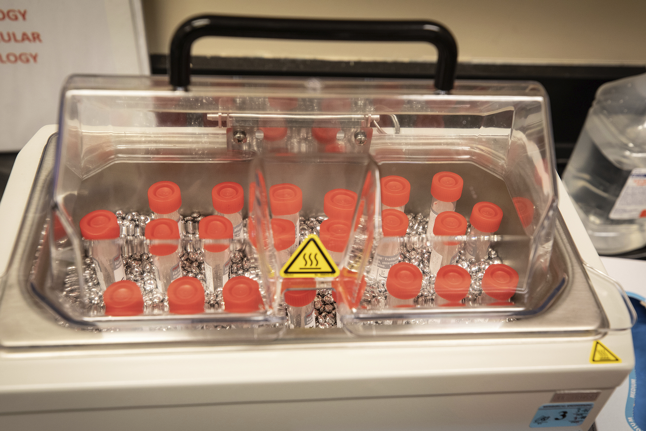 Virus Outbreak Mississippi analiza laboratorija ispitivanje korona