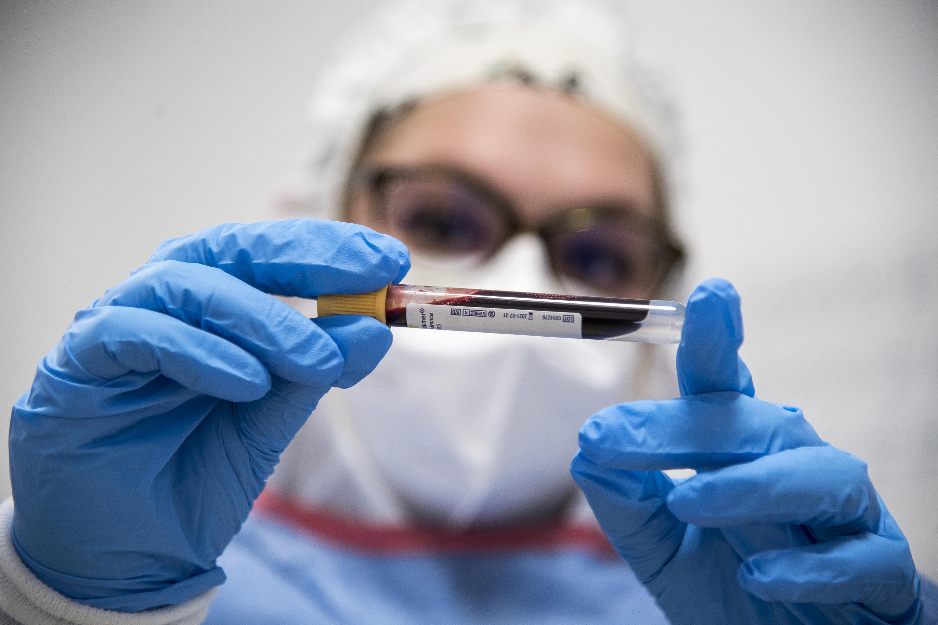 Coronavirus Testing in Italy