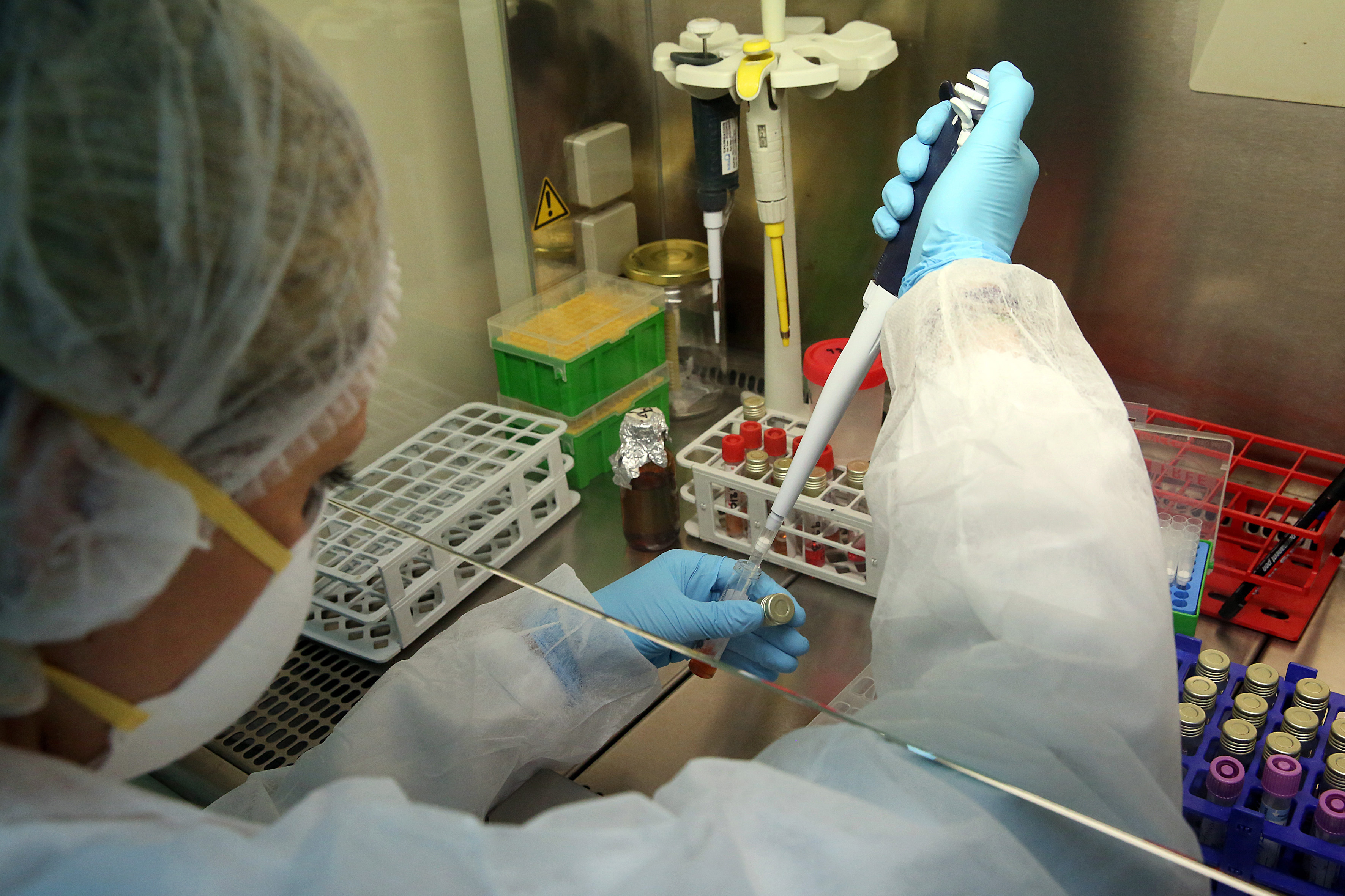 SARS-CoV-2 coronavirus detection tests performed at Greece's Hellenic Pasteur Institute