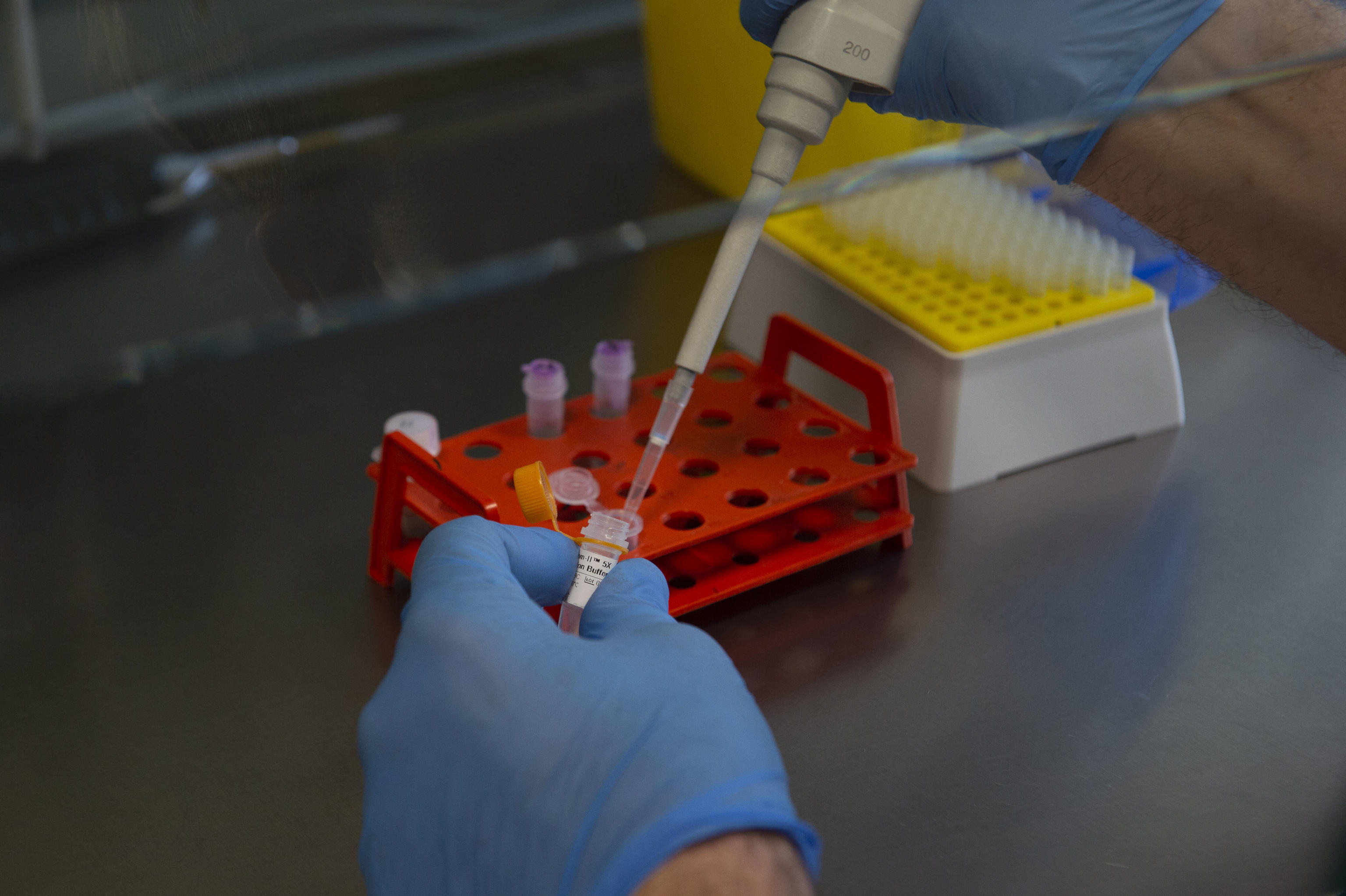 rapid increase of COVID-19 cases in Italy