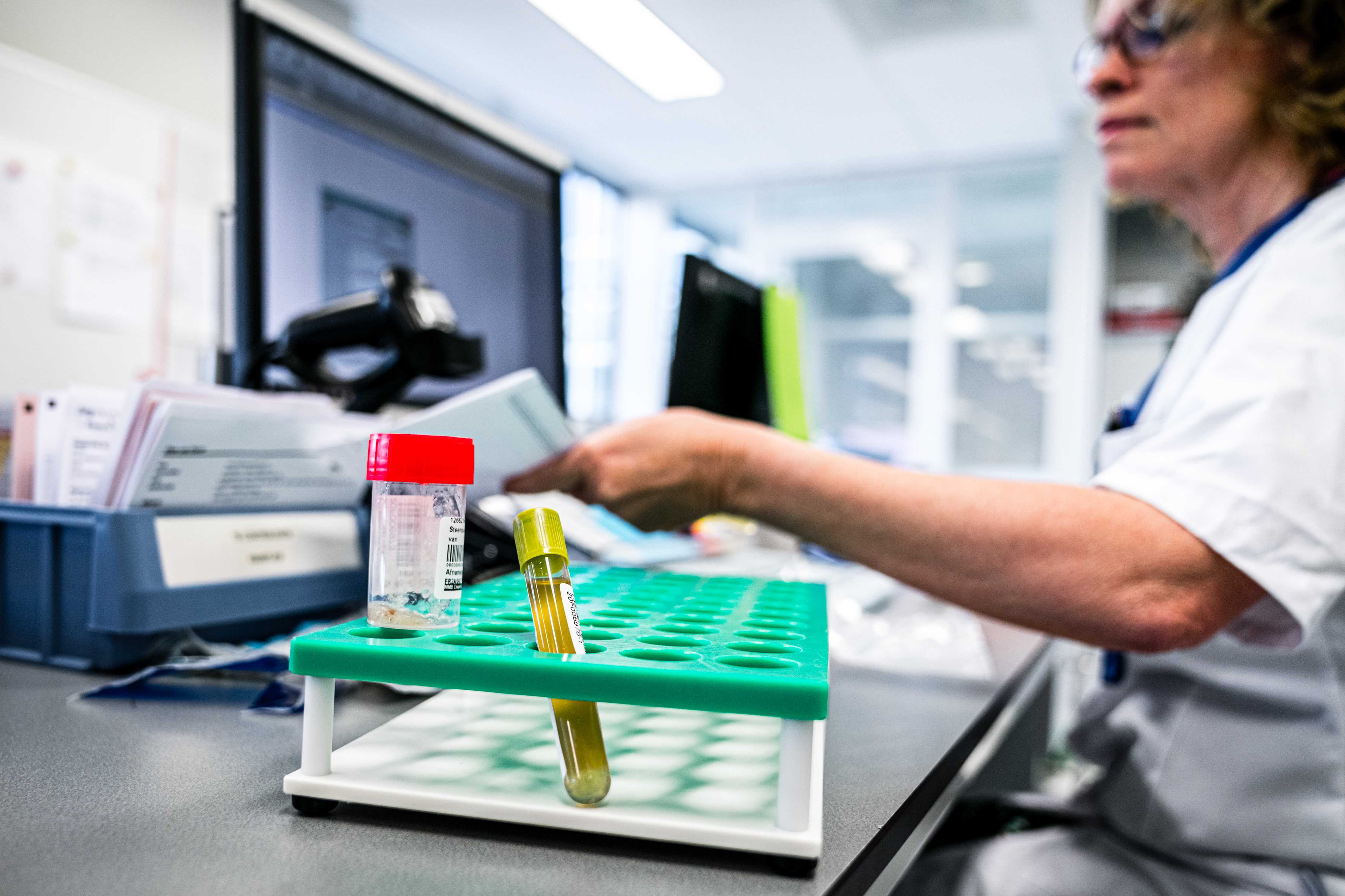 Koronavirus epa08269473 An employee of a medical laboratory receives a sample to test for the coronavirus SARS-CoV-2 in Roosendaal, The Netherlands, 04 March 2020.  EPA-EFE/ROB ENGELAAR