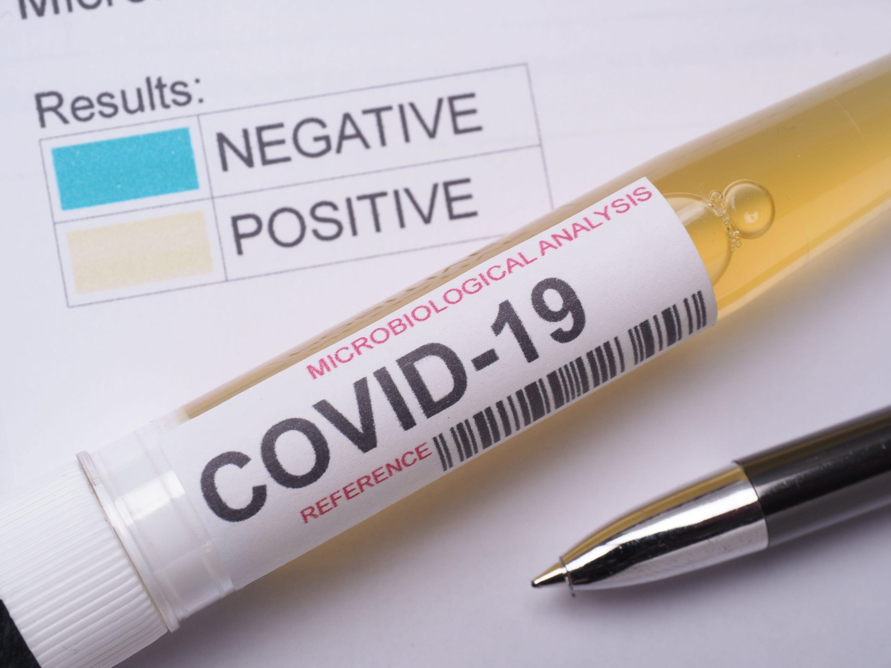 Koronavirus test , Image: 504430509, License: Royalty-free, Restrictions: , Model Release: no, Credit line: Claudio Rampinini / Alamy / Alamy / Profimedia