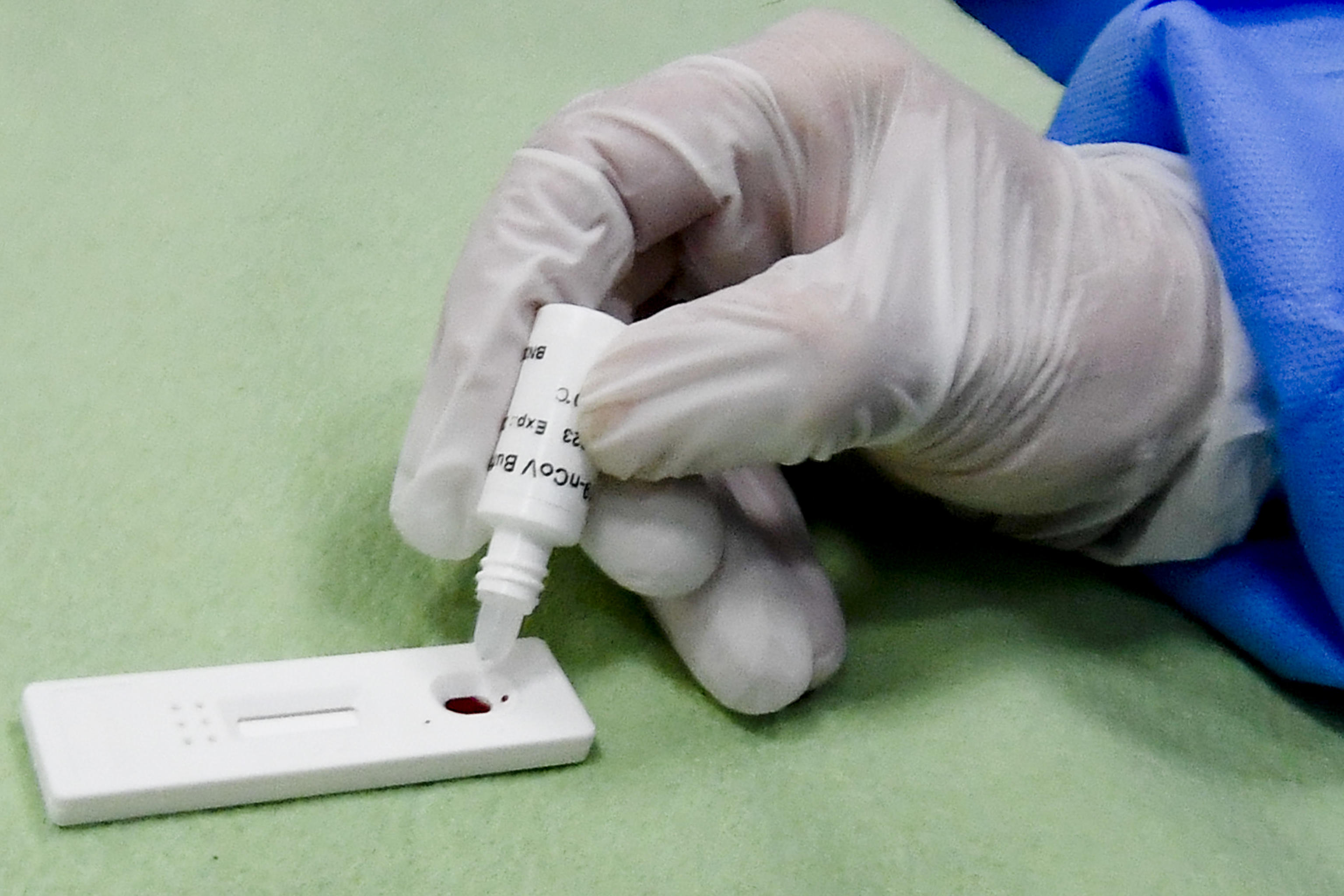 Naples hospital starts rapid tests to detect coronavirus disease COVID-19 infections on health workers