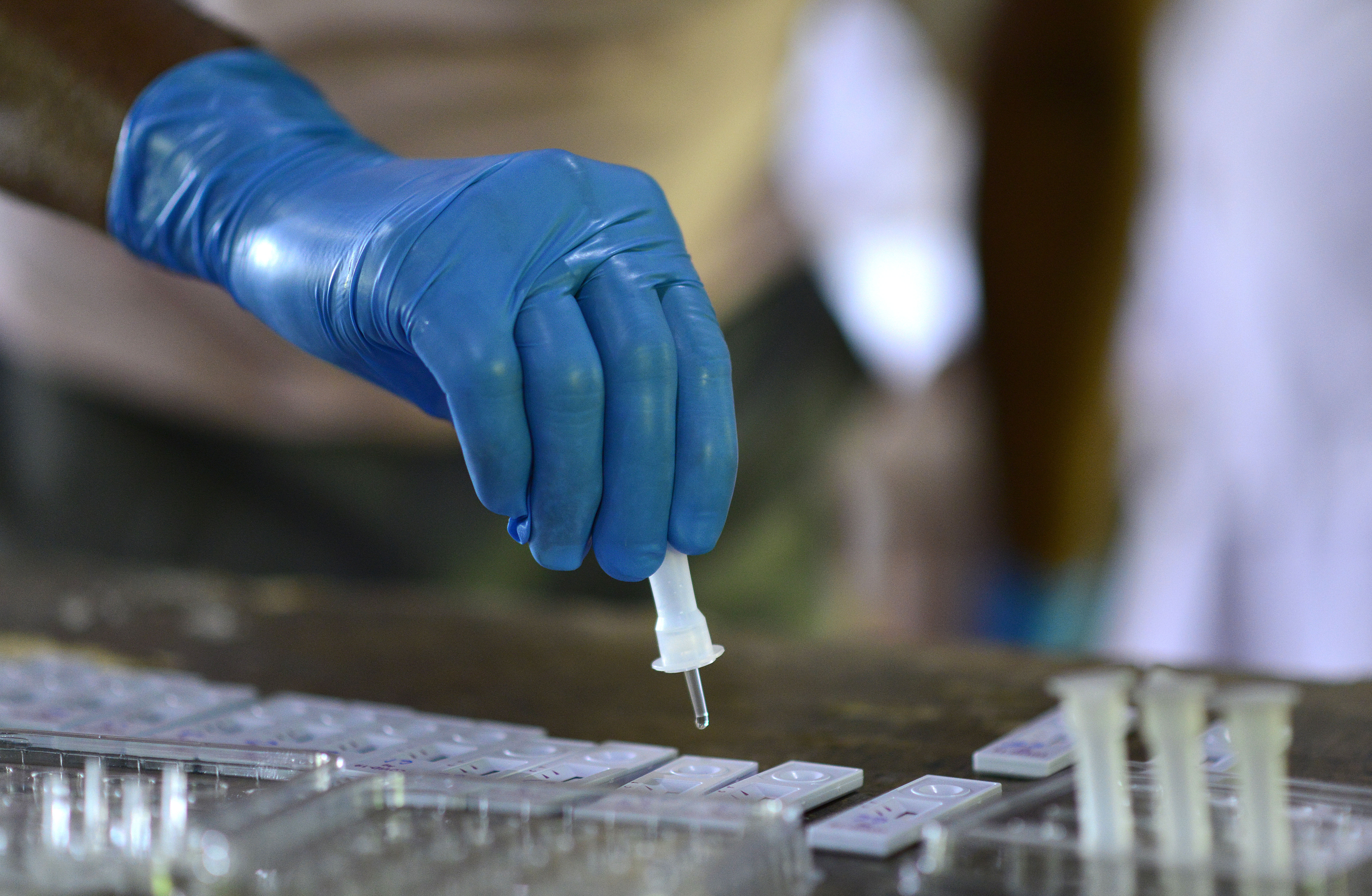 koronavirus test testiranje