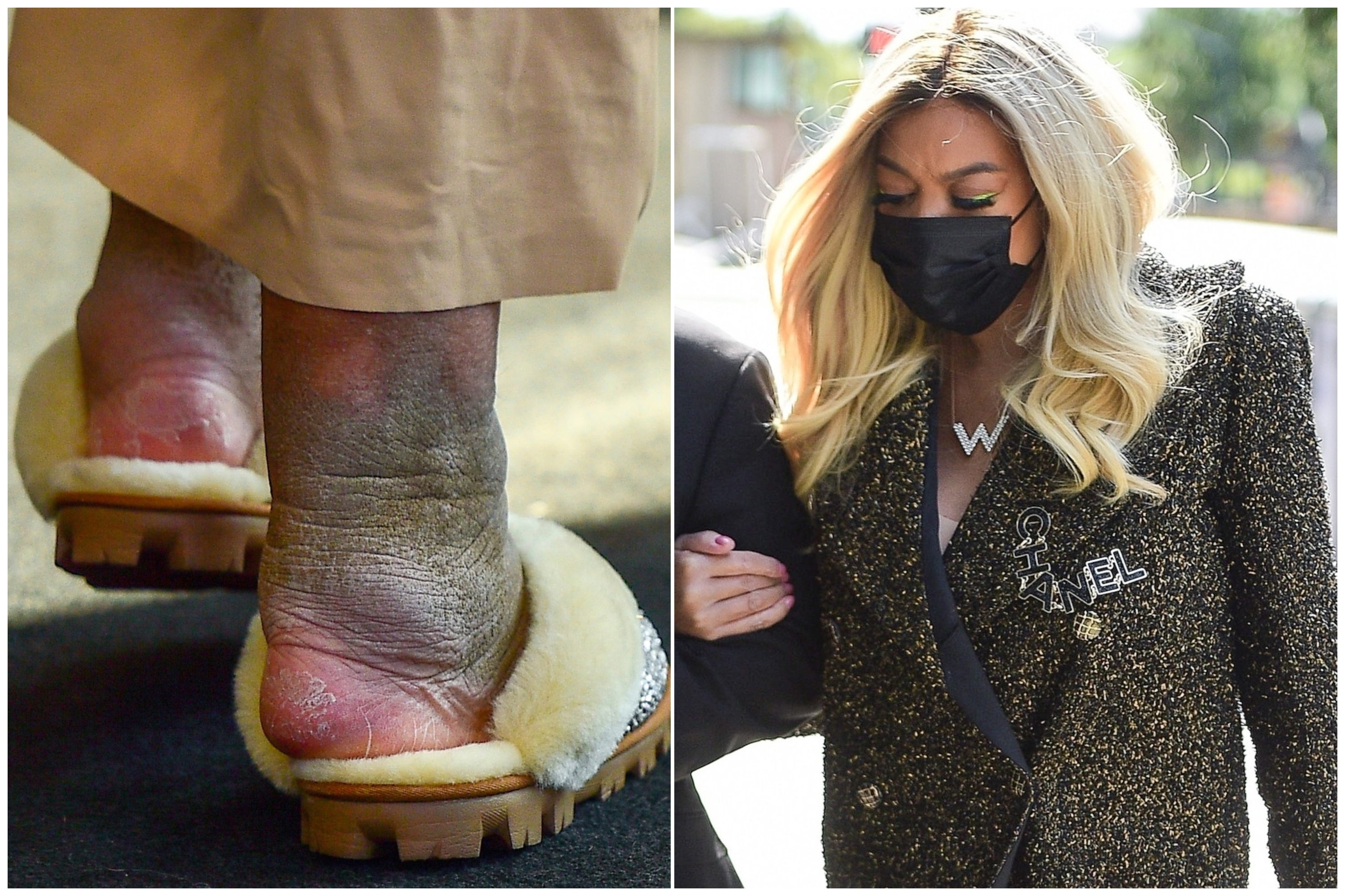 New York, NY  - *PREMIUM-EXCLUSIVE*  - *EXCLUSIVE*  -  TV Host  Wendy Williams, who has been diagnosed with lymphedema, a condition that causes swelling in her legs and feet, pictured arriving at her NYC offices Wednesday morning.
