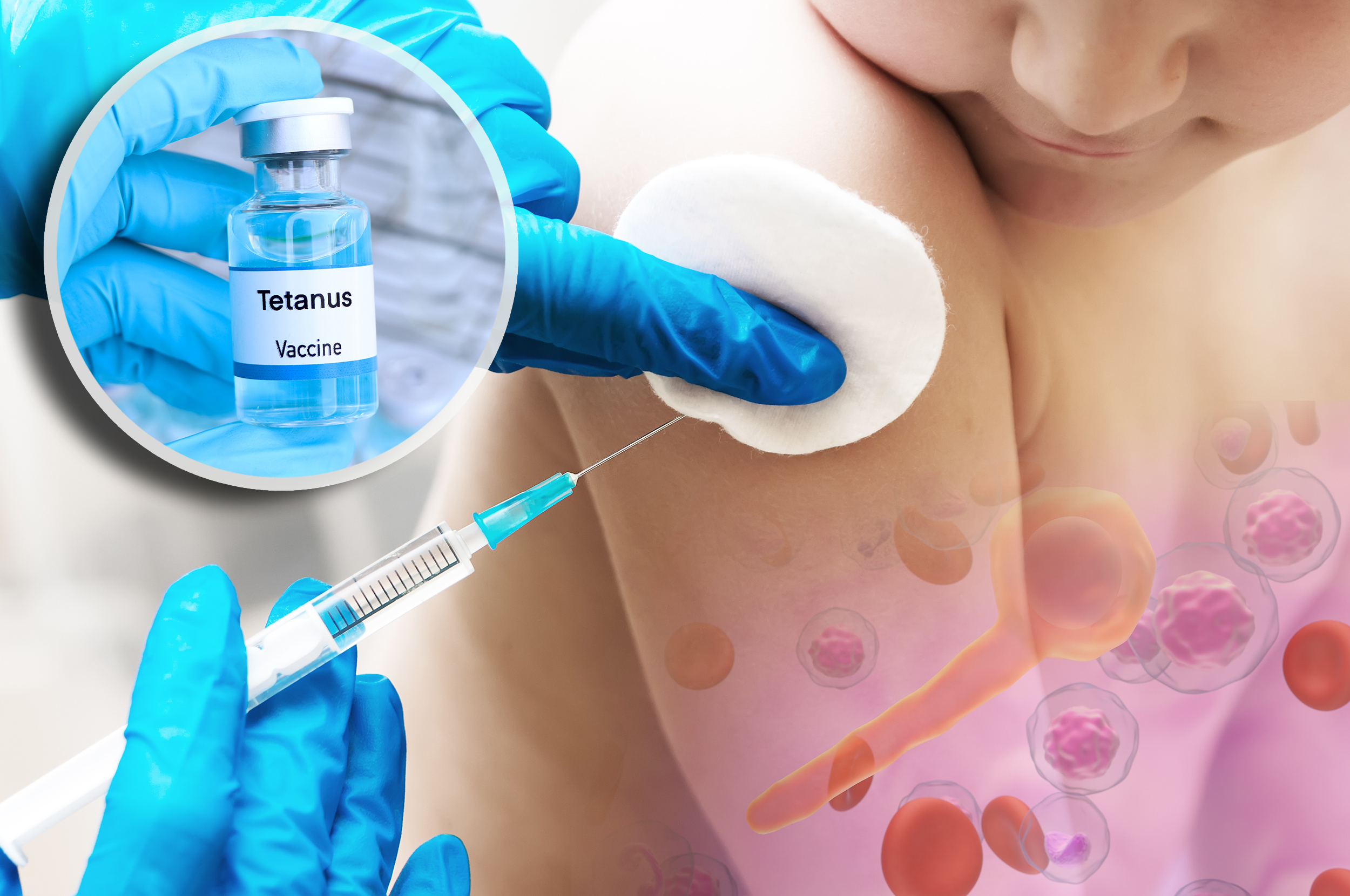tetanus vakcina