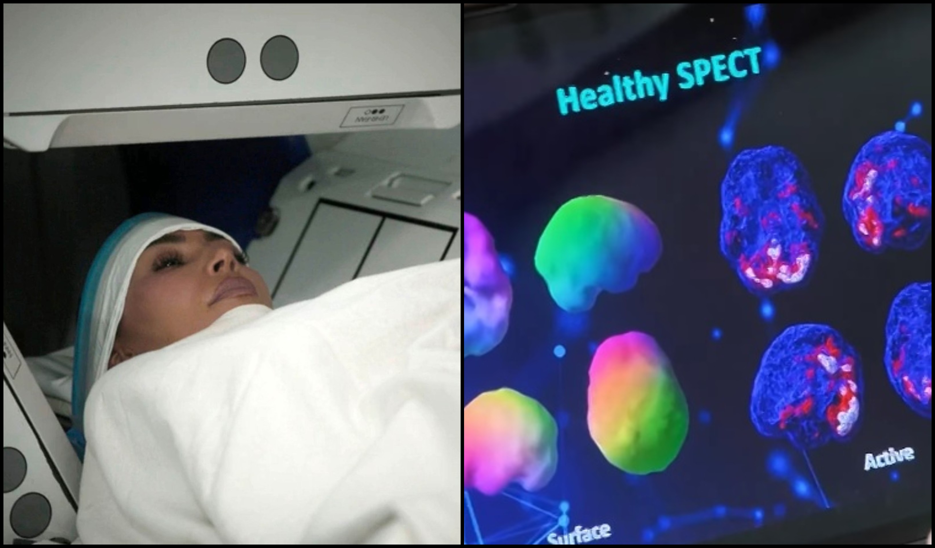 Snima mozga Kim Kardašijan